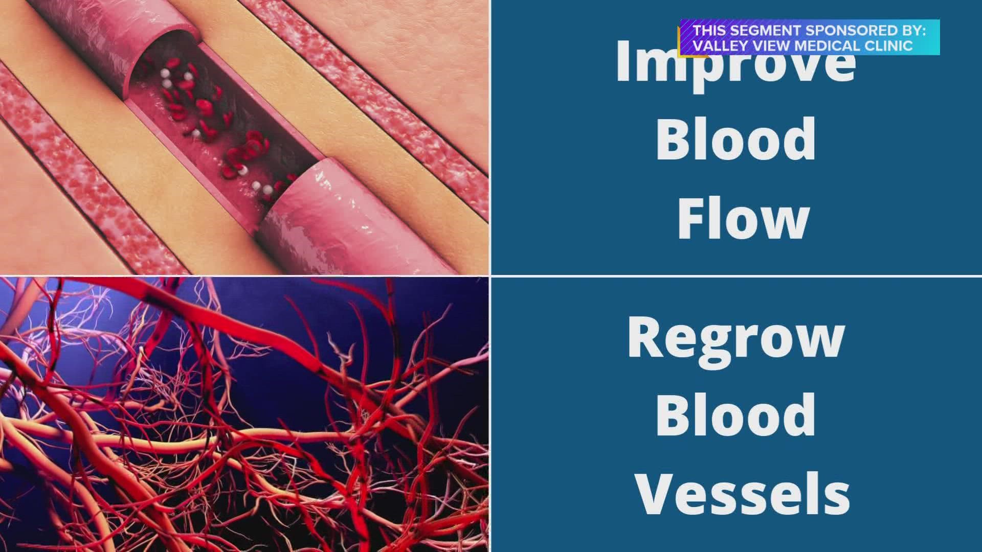 Andrew Rinehart, Valley View Medical Clinic, explains how acoustic wave therapy can help repair & regrow damaged blood vessels with a few treatments | Paid Content