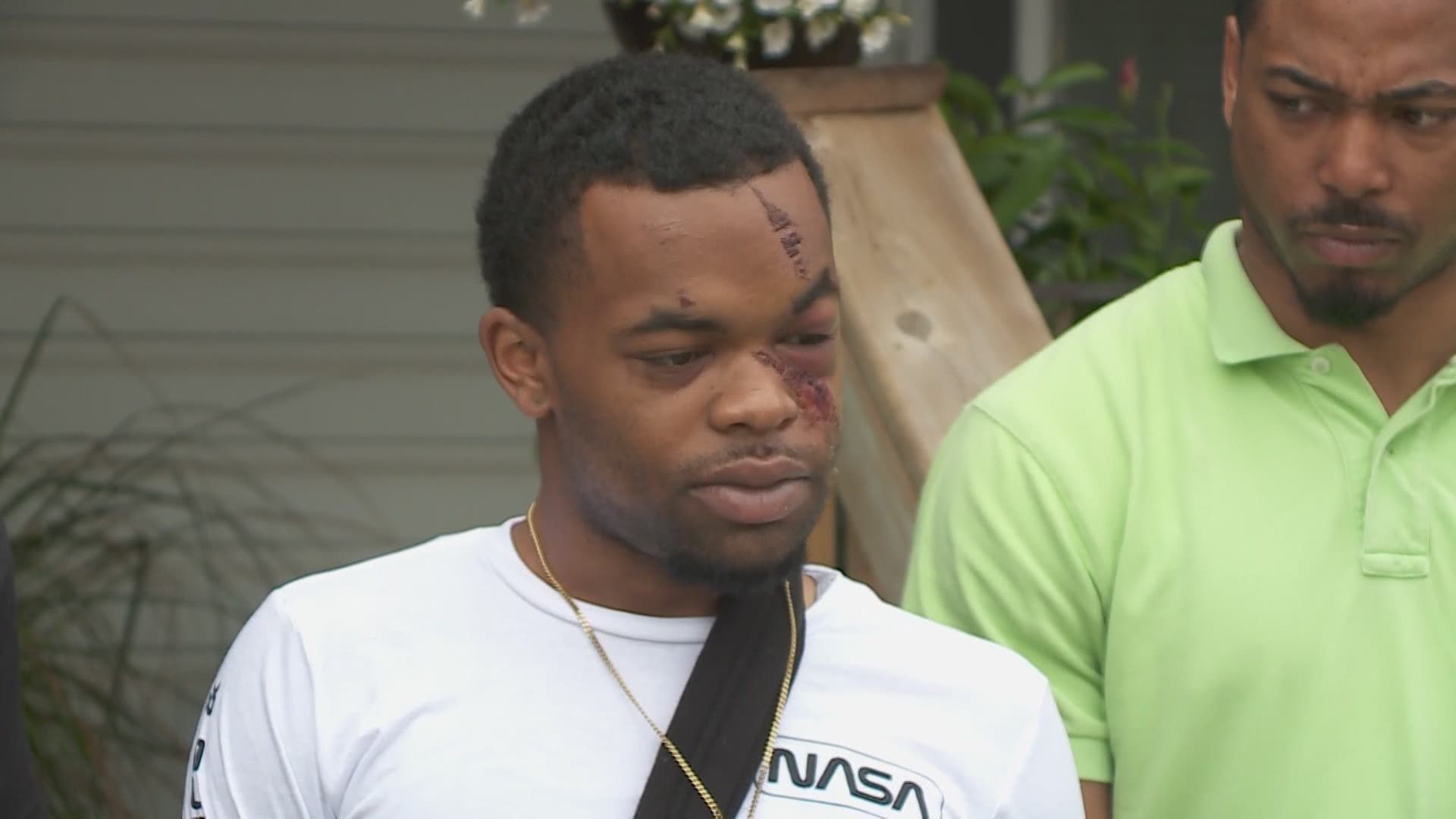 Darquan Jones, a young black man, was walking to see his girlfriend early Saturday morning when he was jumped by two white men, one of which shouted racial slurs.