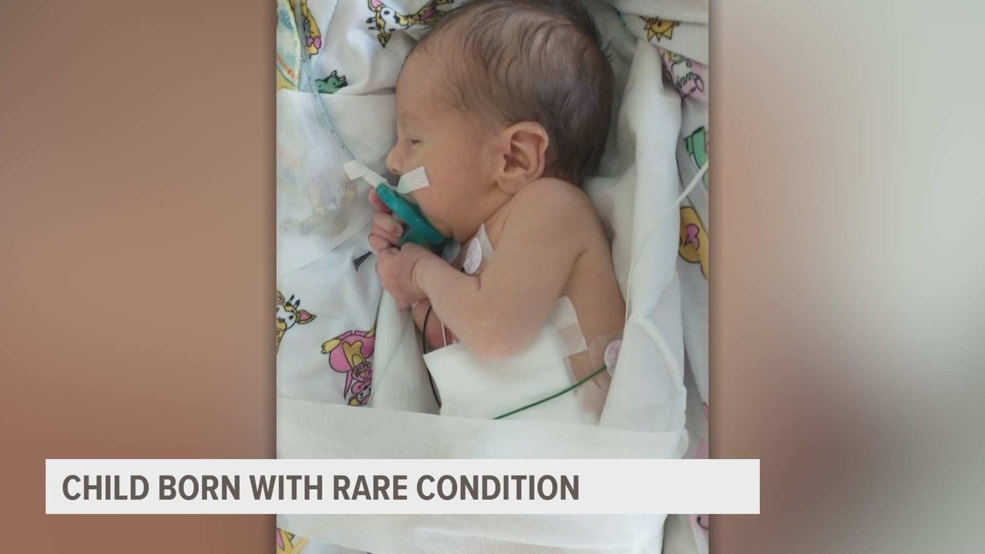 Community members are raising funds to help the mother of a child born with a rare condition, who hasn't left the hospital since birth.
