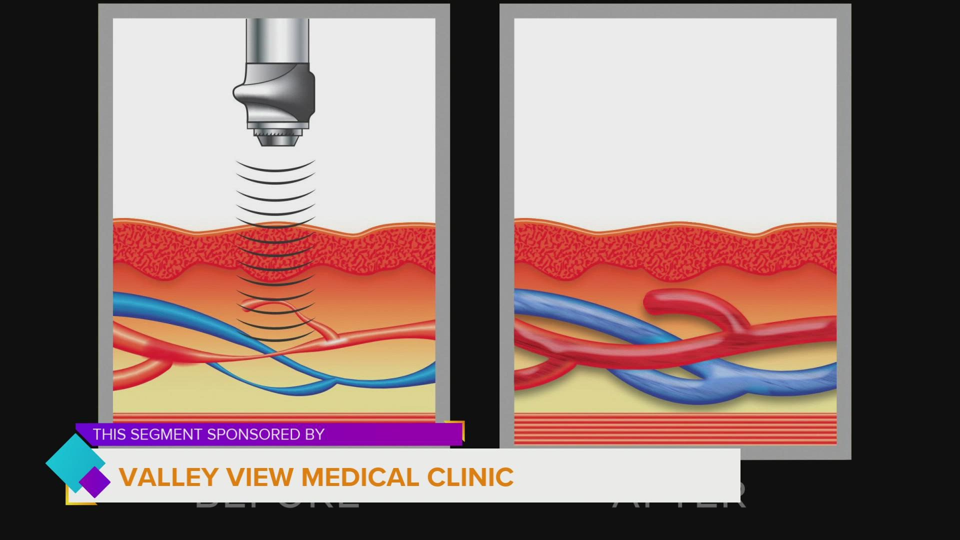 Valley View Medical Clinic uses the latest Acoustic Wave Therapy to treat patients 6 days a week | Paid Content