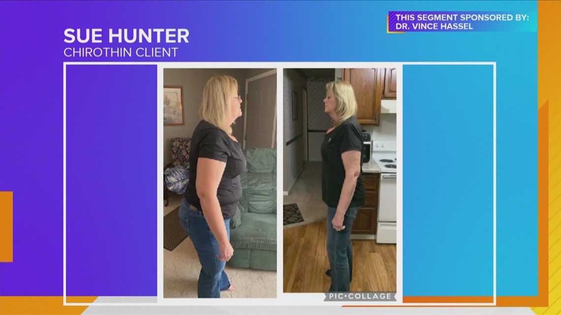 Woman loses 50 pounds and is amazed by how 