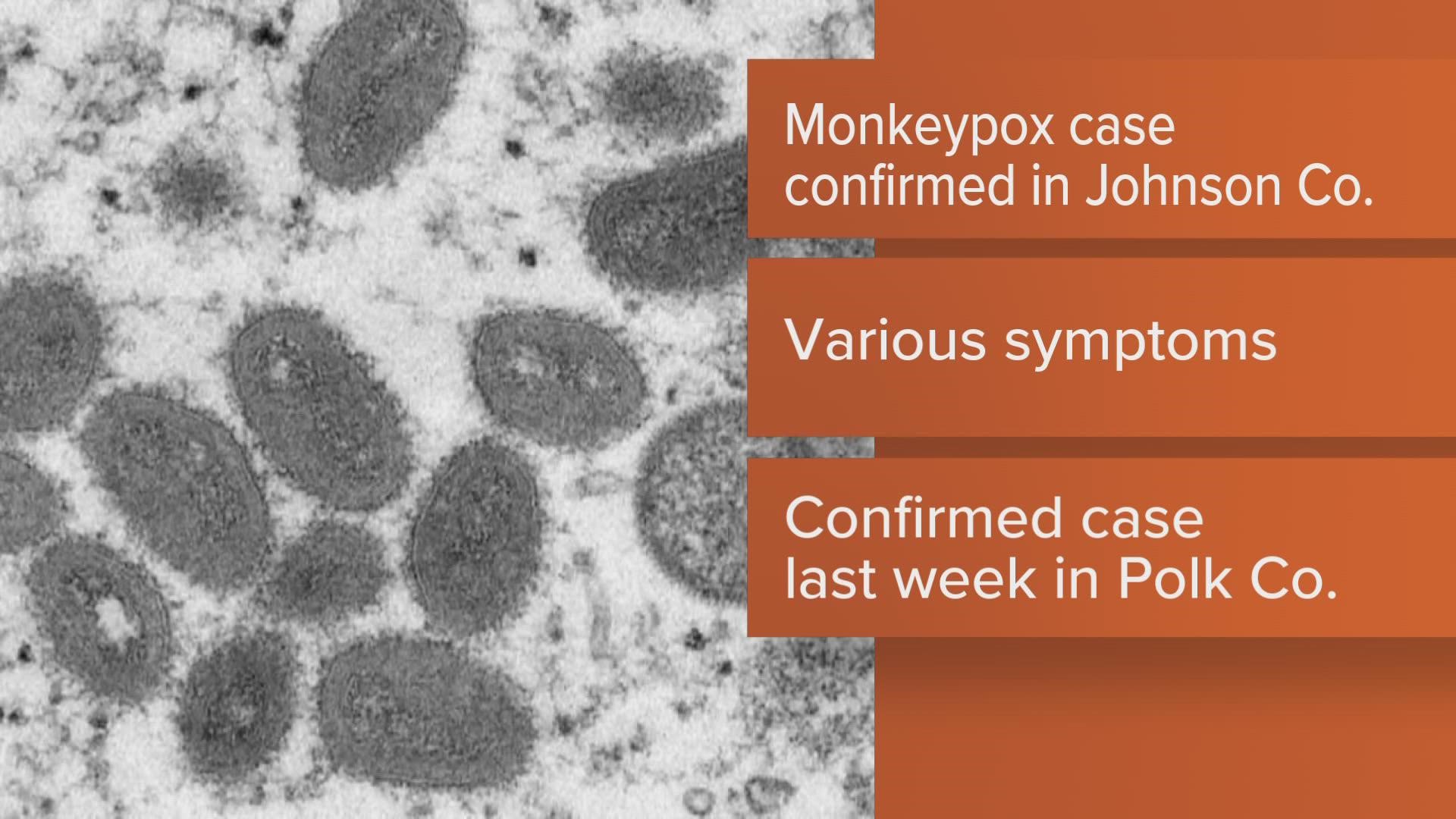 Polk County health leaders confirmed a monkeypox case last week.