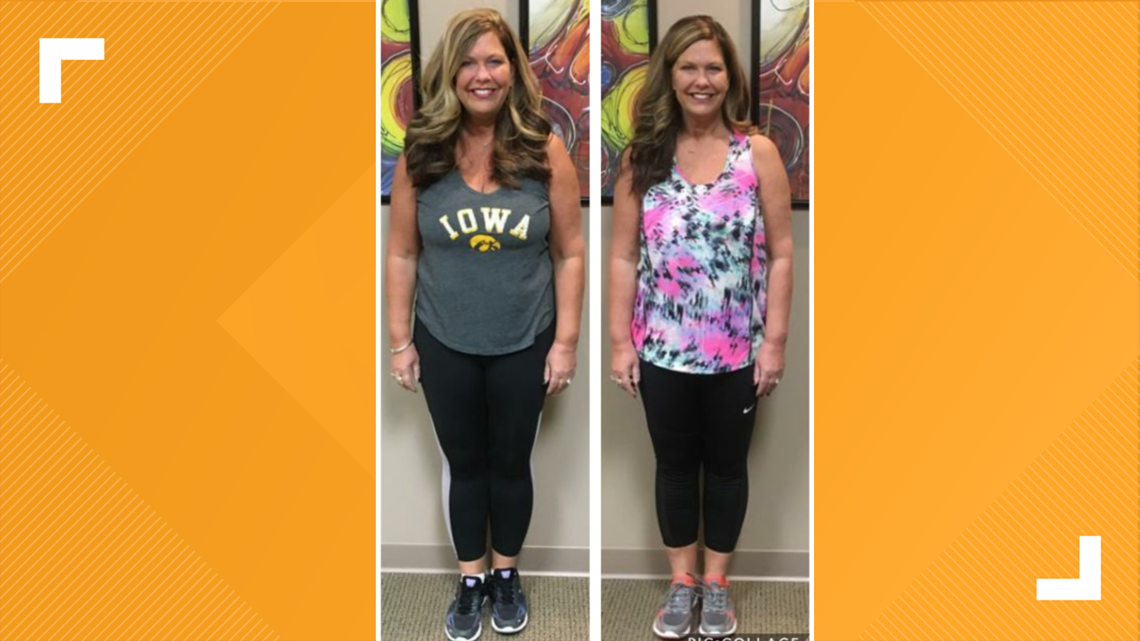 Krista loses a lot of weight with Dr. Hassel's weight loss program