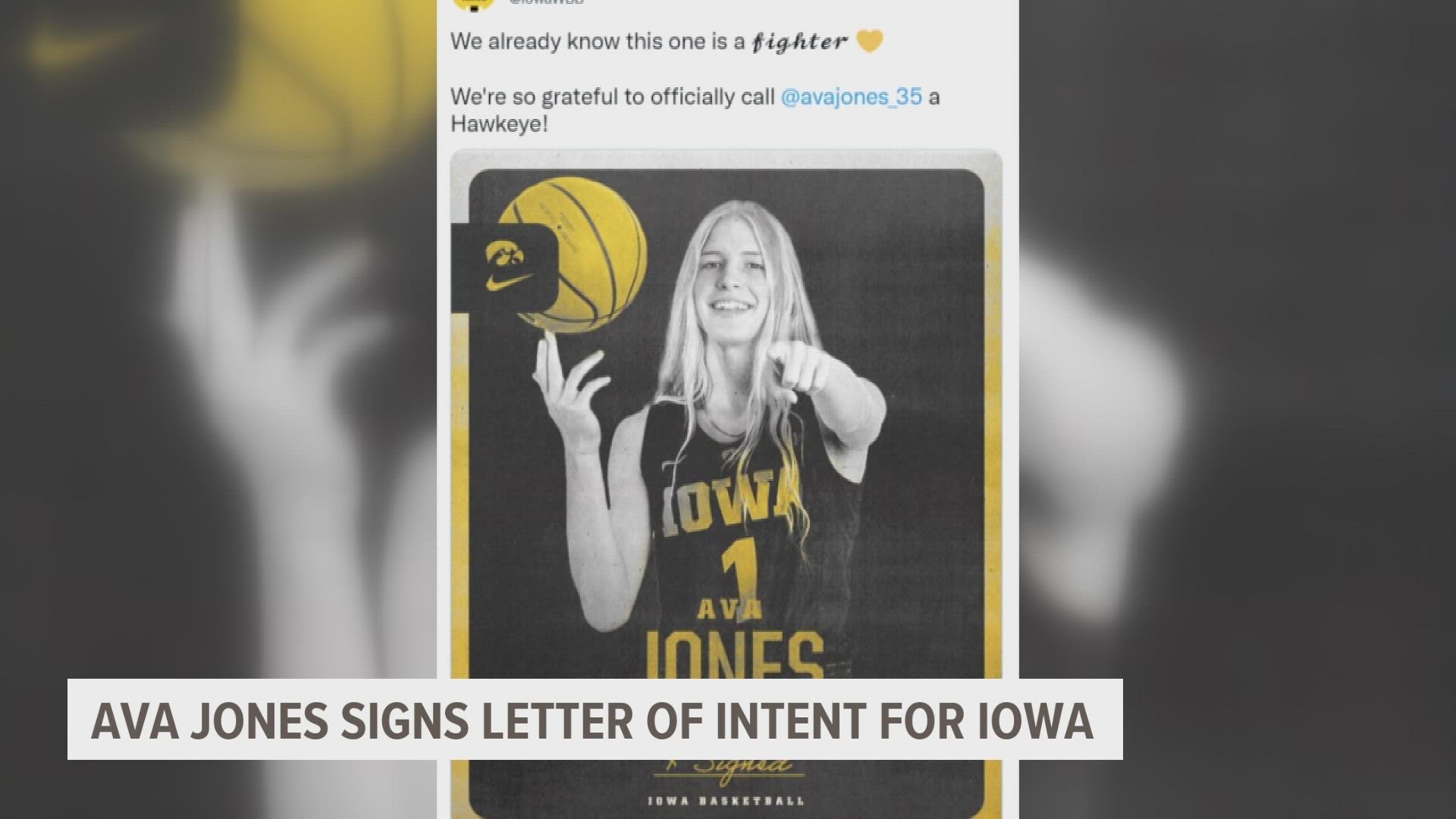 Iowa has already said they'd honor Jones' scholarship even if she's not able to return
to the court, tweeting that they're grateful to call her a Hawkeye.