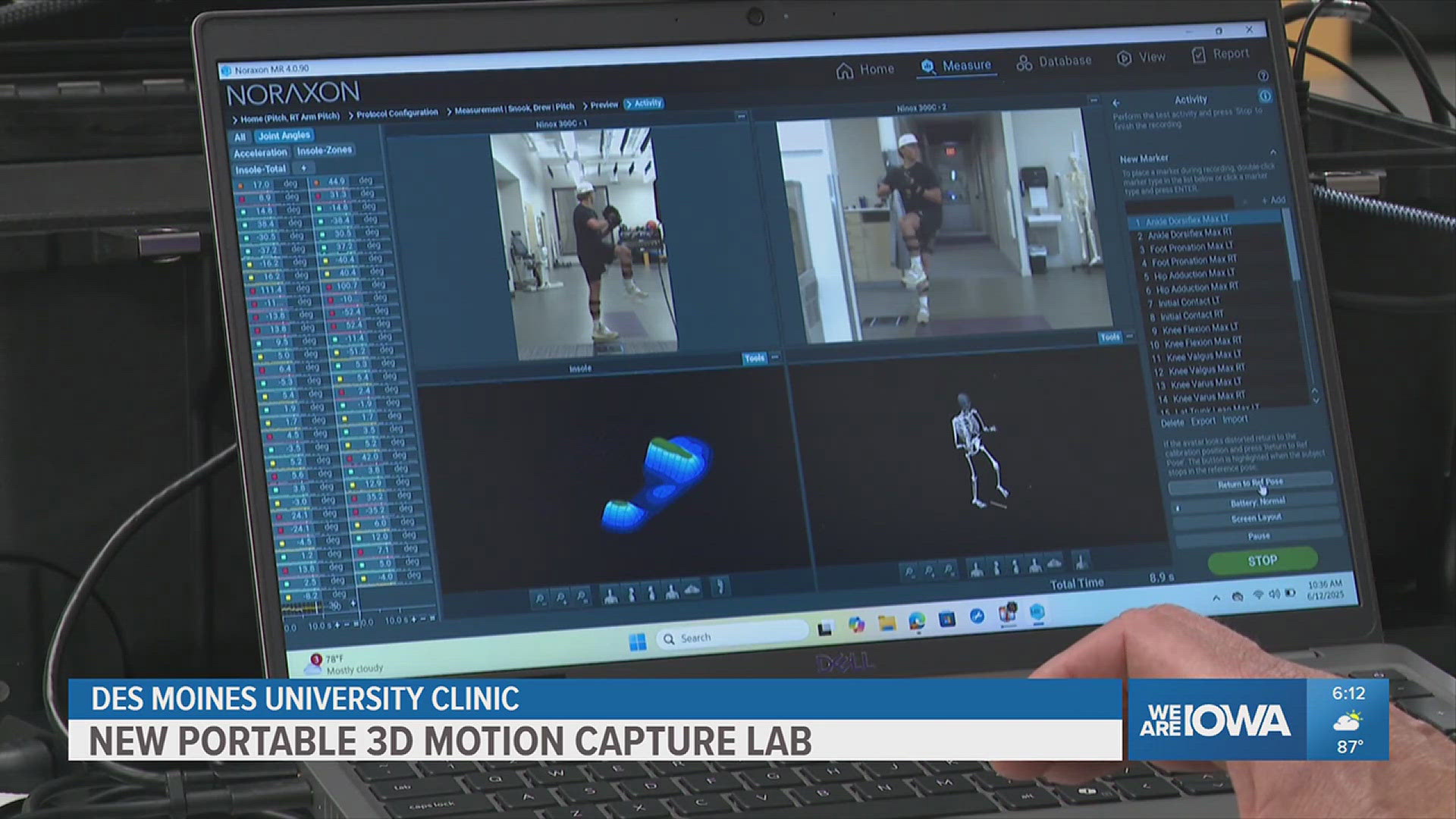 Motion Capture Camera Lab Des Moines University Clinic debuts new portable 3D motion capture lab ...
