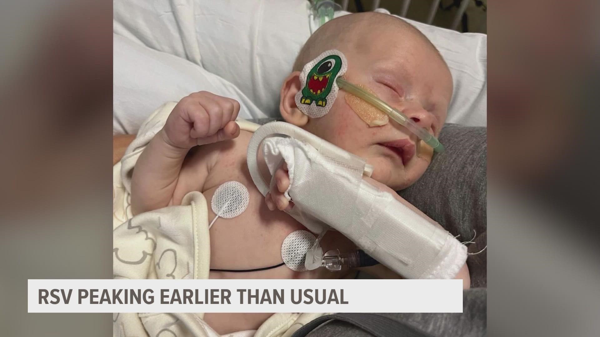 RSV, a respiratory illness found in children, is on the rise across the country, worrying doctors and parents of young children.