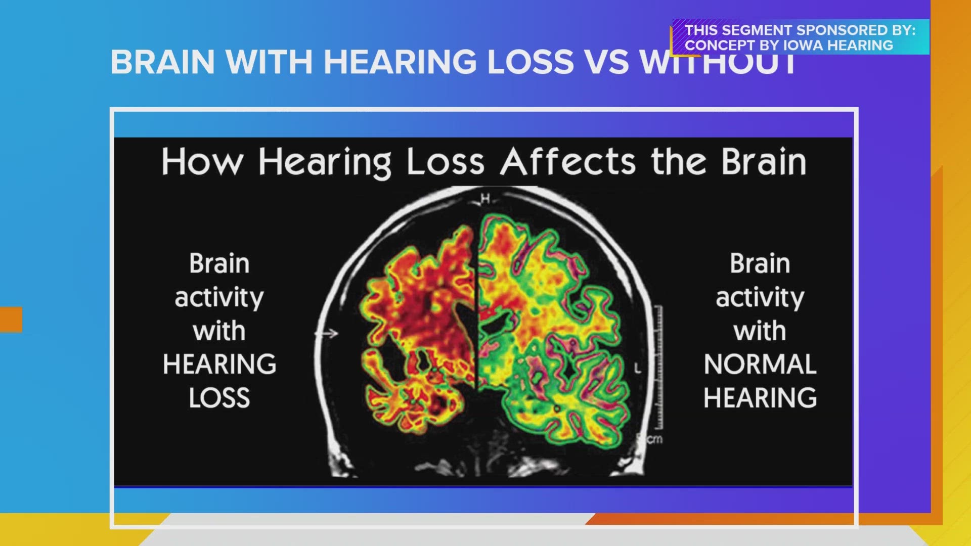 Taylor Parker, Concept by Iowa Hearing, talks about importance of correcting hearing loss, and how to help a loved one Hear for the Holidays | Paid Content