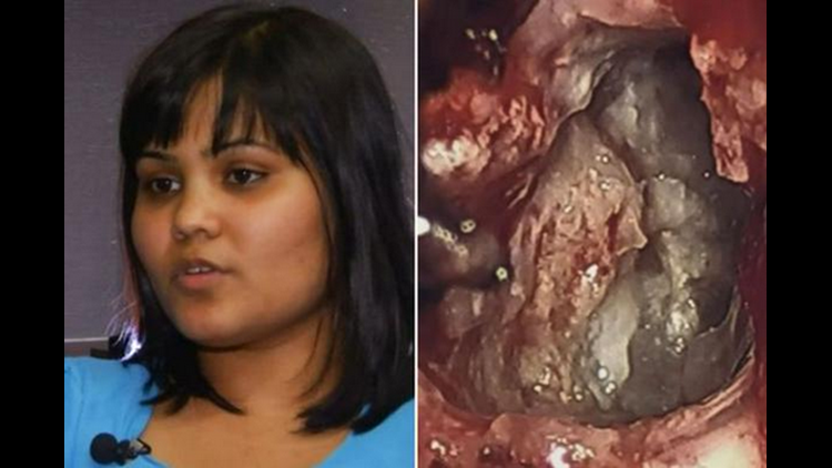 Evil twin' removed from woman's brain complete with bone, hair and teeth |  
