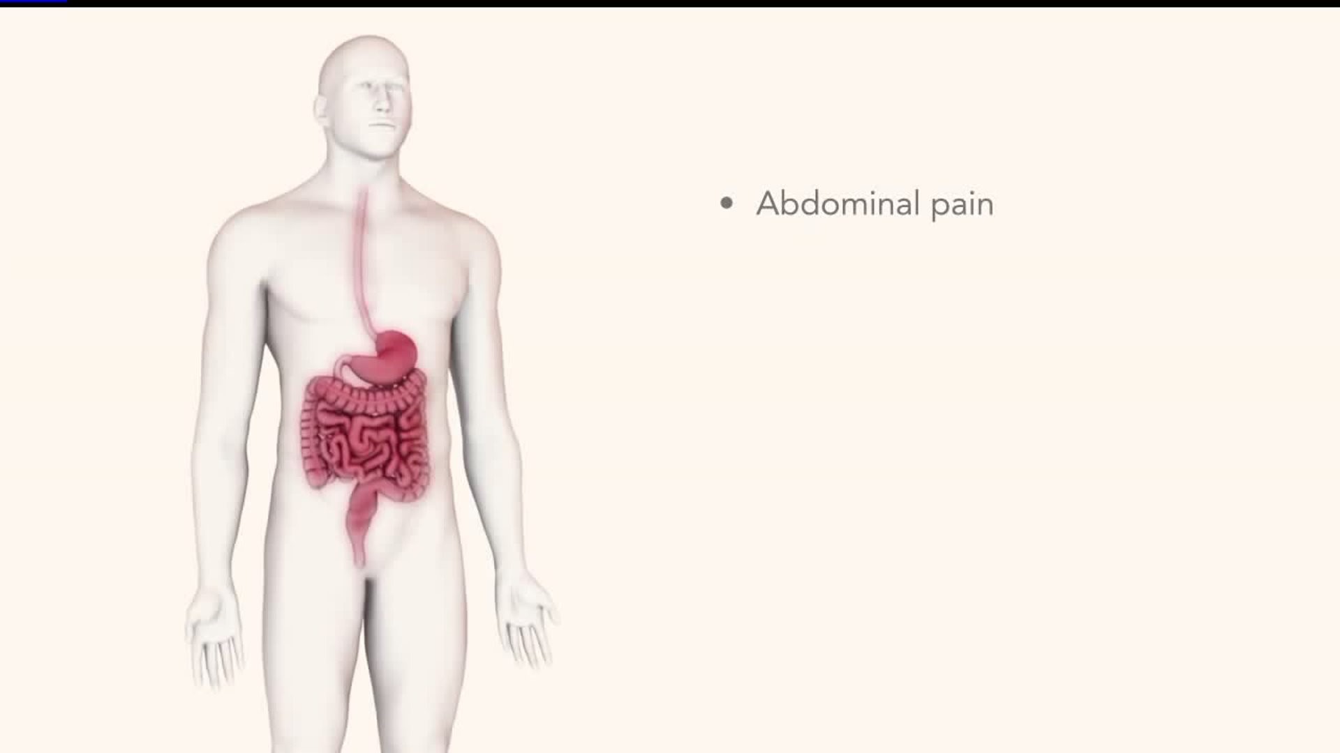 Conquering Crohn`s: What is Crohn`s Disease?