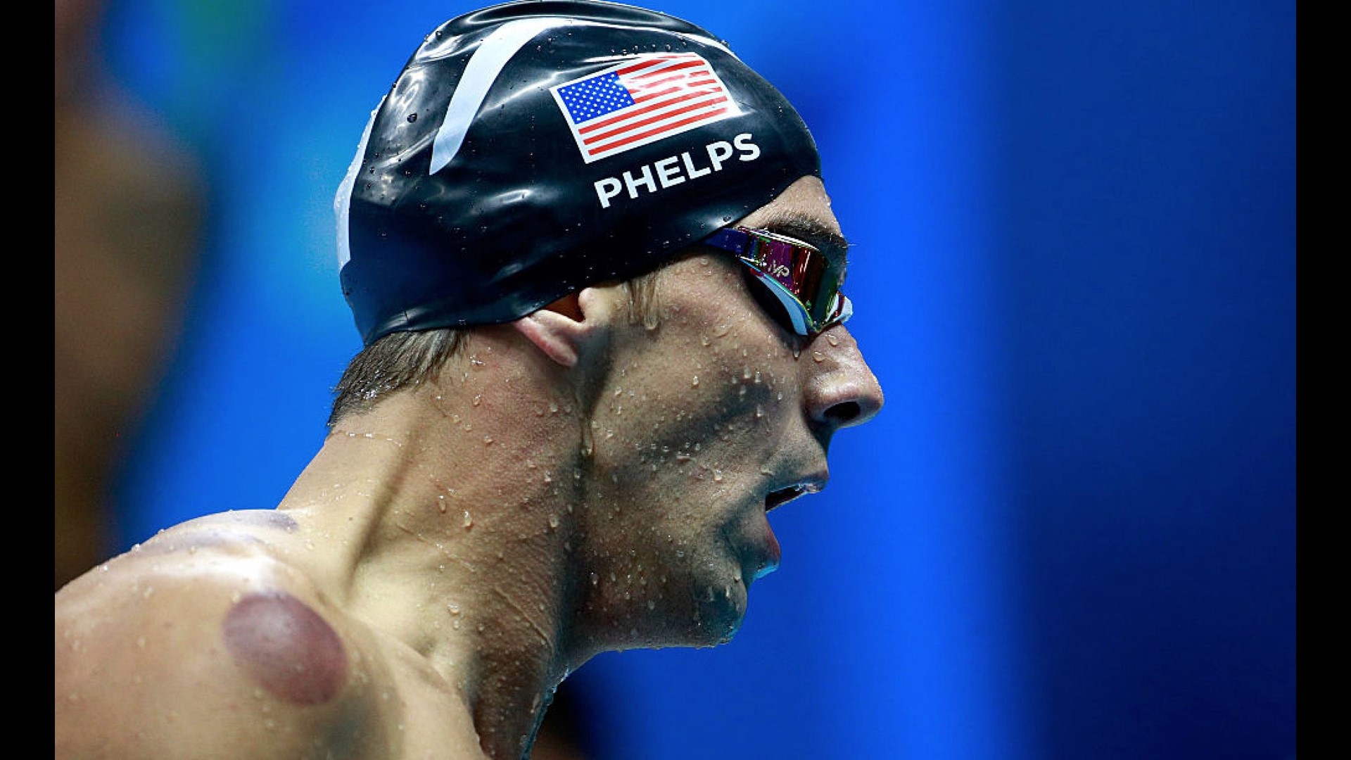 What were those dark red circles on Michael Phelps’ body?