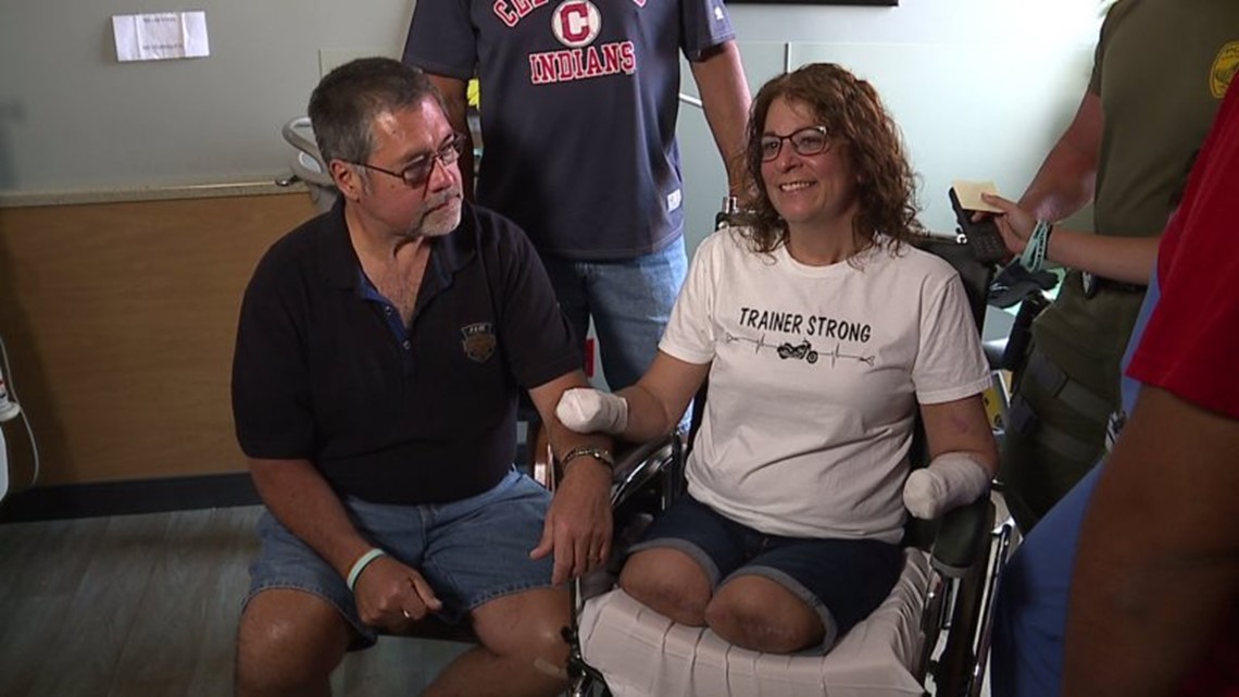 Woman Wakes From Coma To Find Legs Arms Partially Amputated After