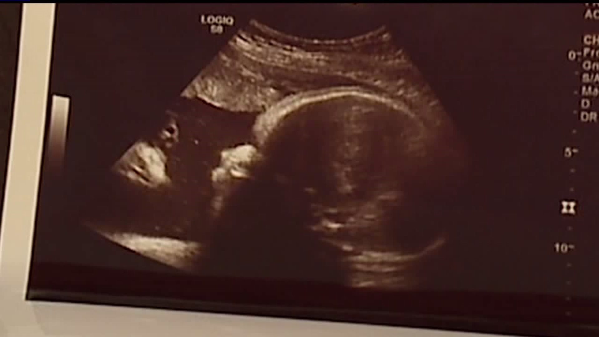 Spiritual sonogram offers local couple relief. What do you see?