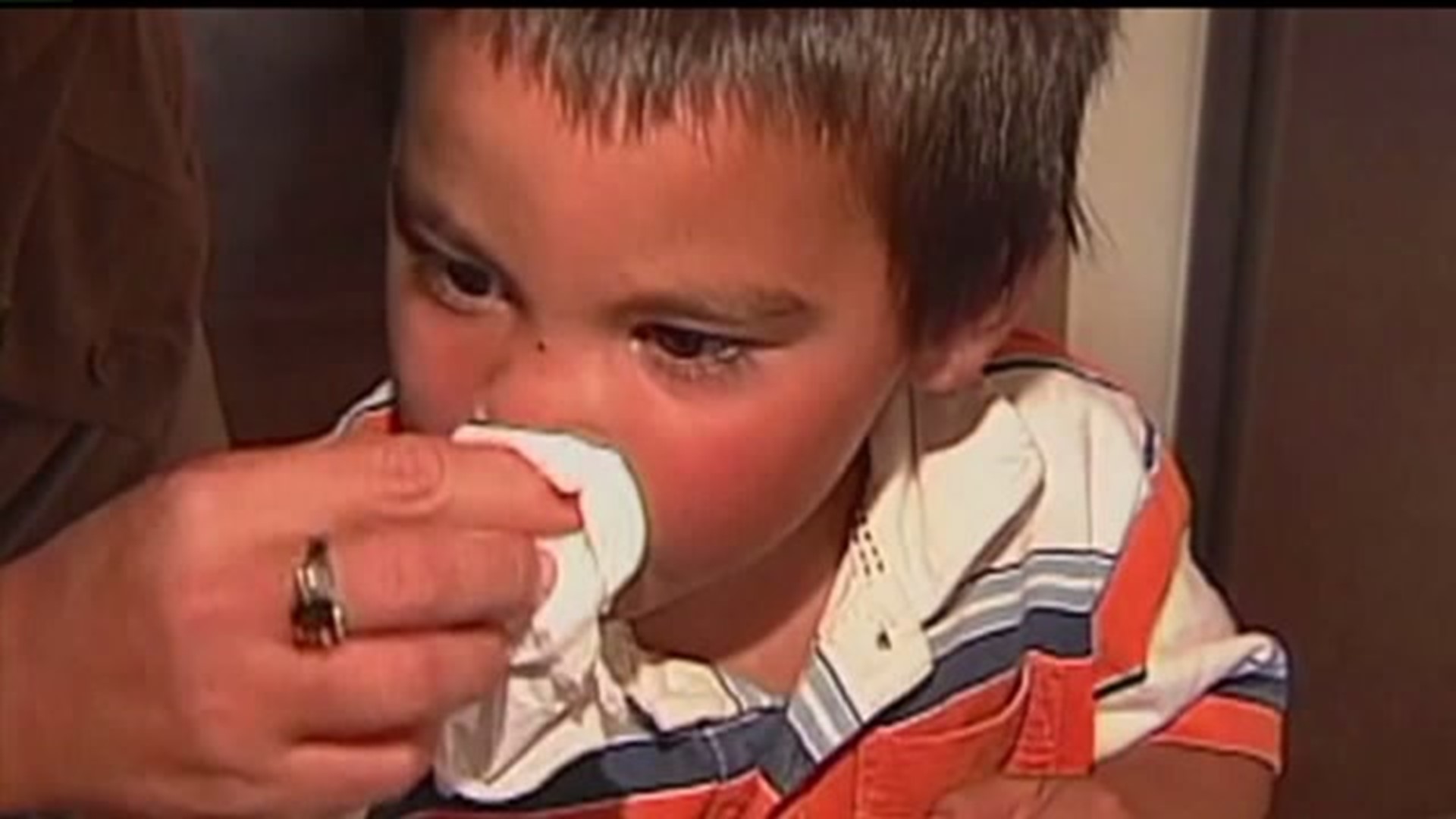 How to treat allergies in kids