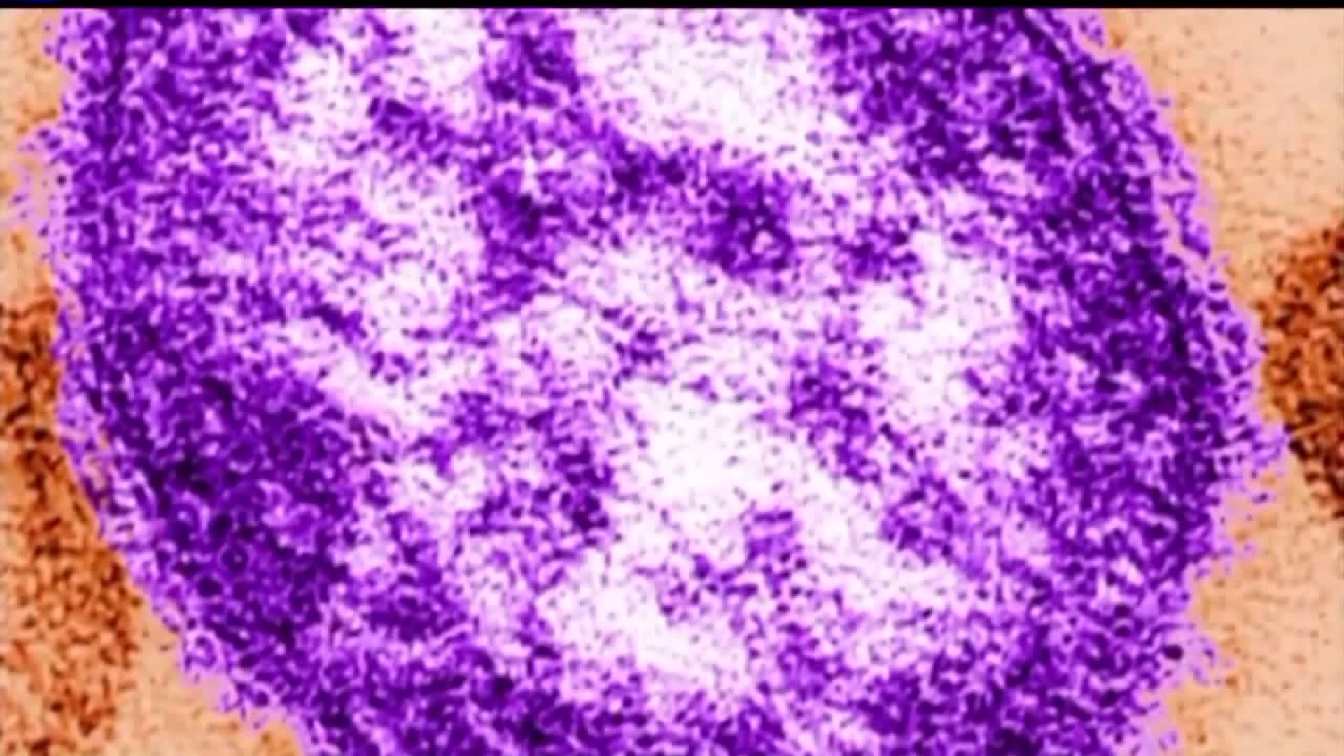 The unvaccinated child visited the Children's Hospital of Philadelphia's King of Prussia campus emergency room on Feb. 26, the county's Department of Health said.