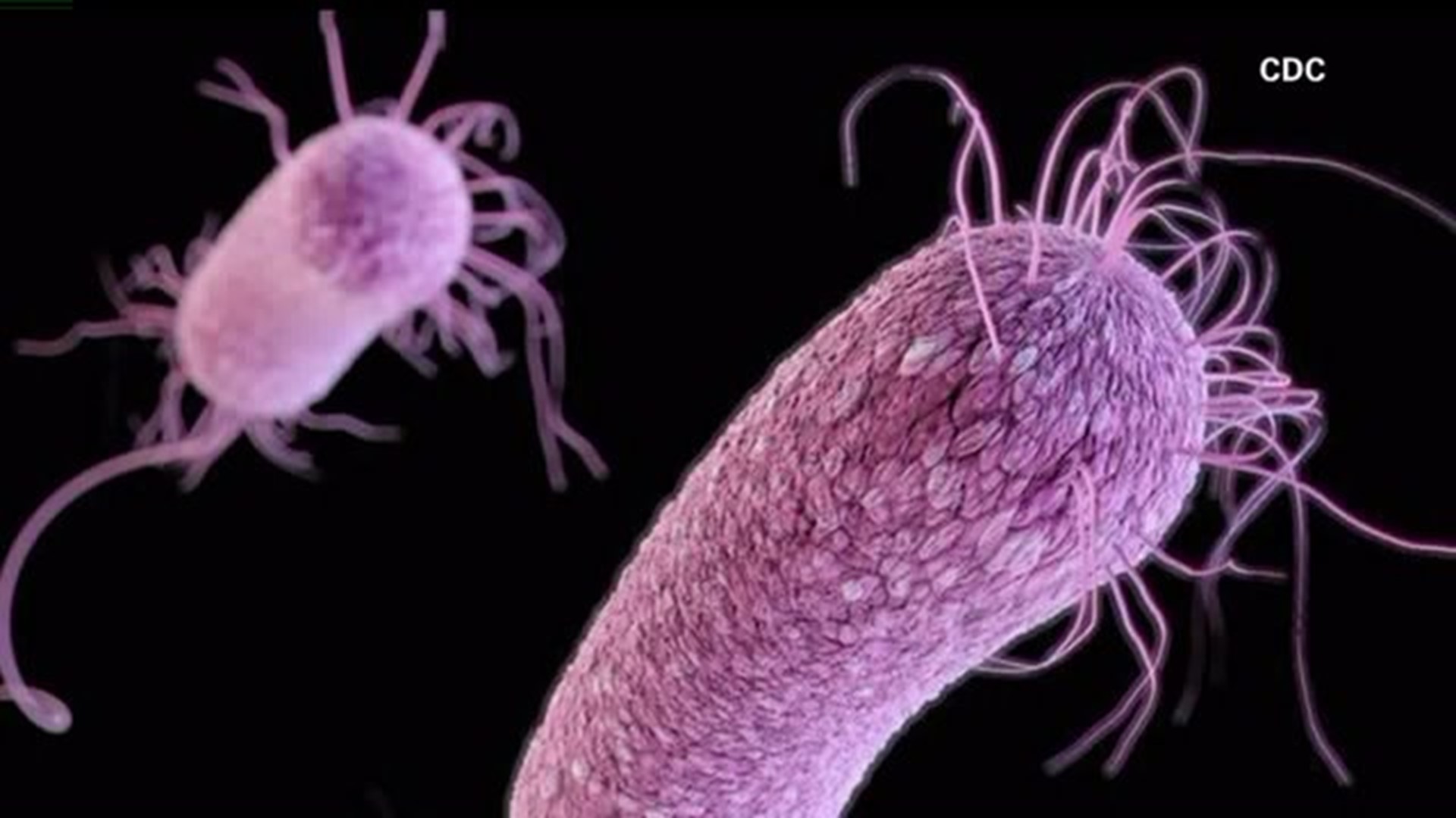 Officials not talking about superbug