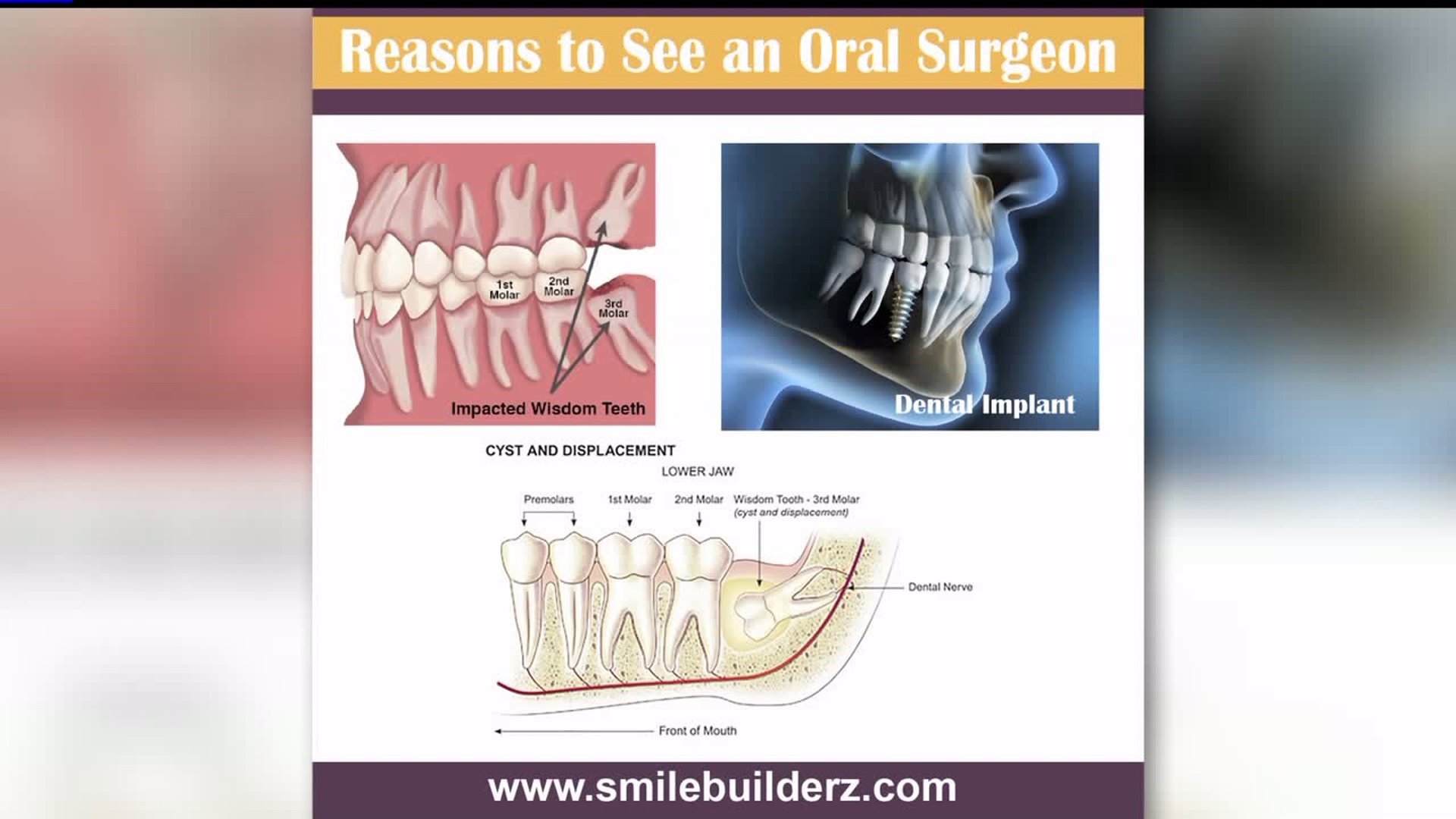 Oral surgery is an option to fix a number of possible issues