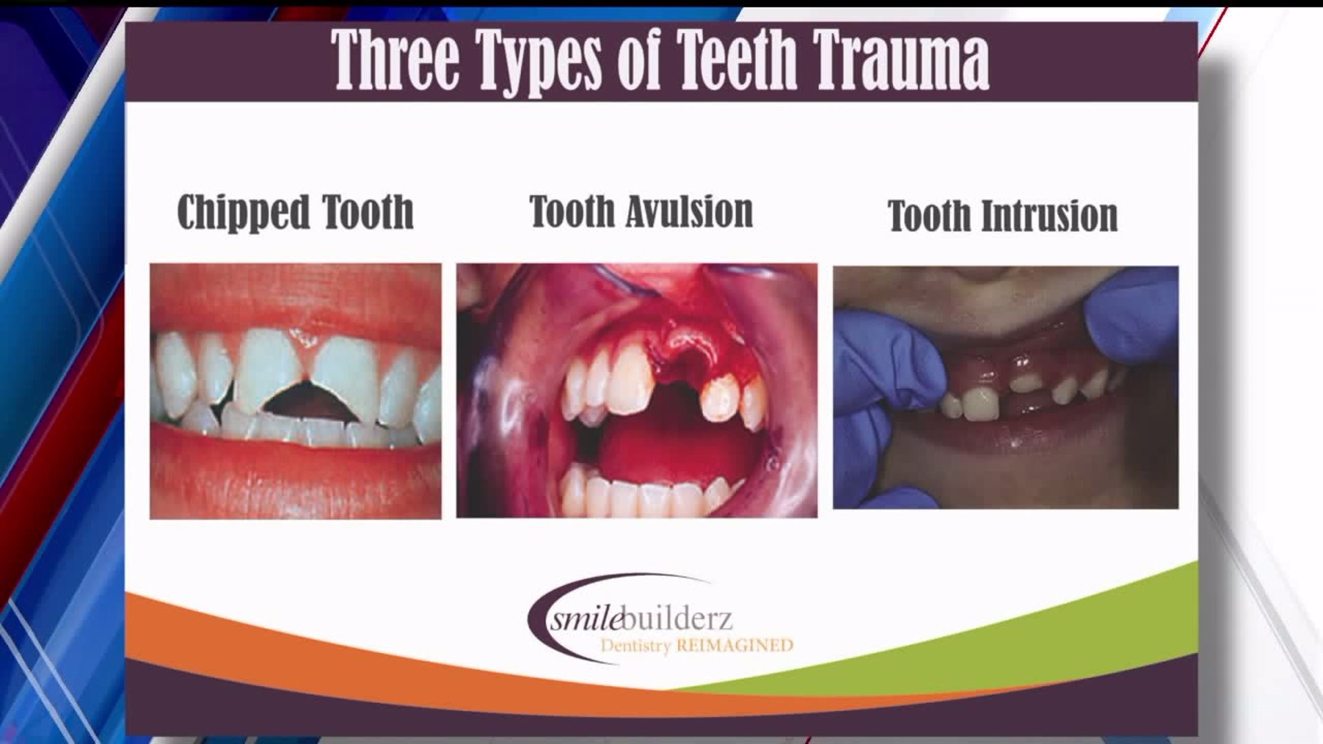 Traumatic dental injuries can be treated with a few options