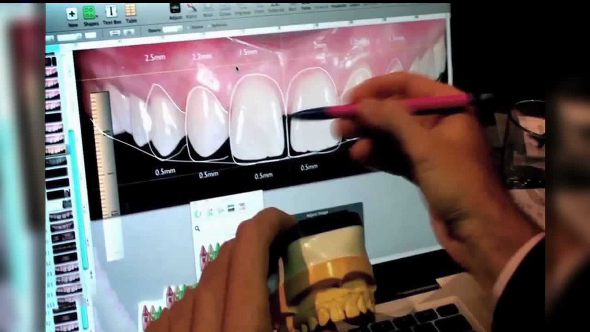 Smilebuilderz helps patients visualize procedure outcomes with Digital Smile Design