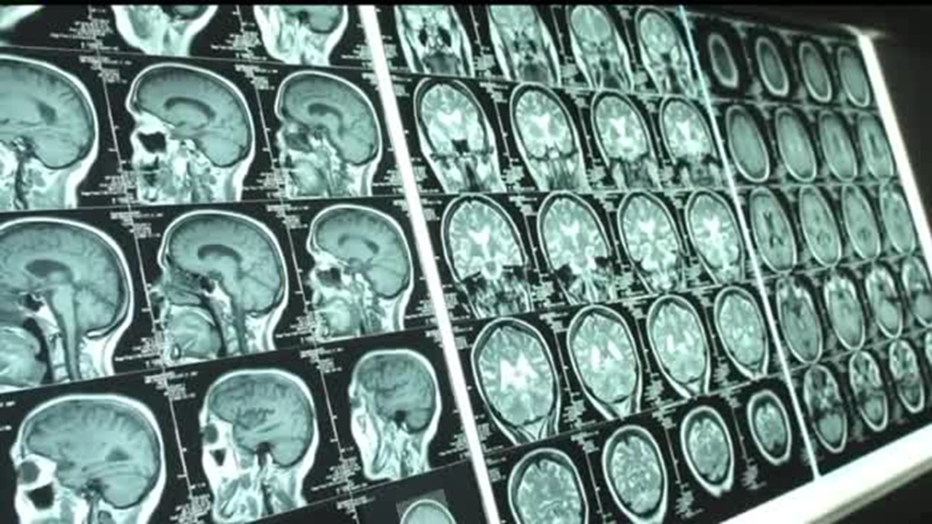 Study examines brain damage in football players