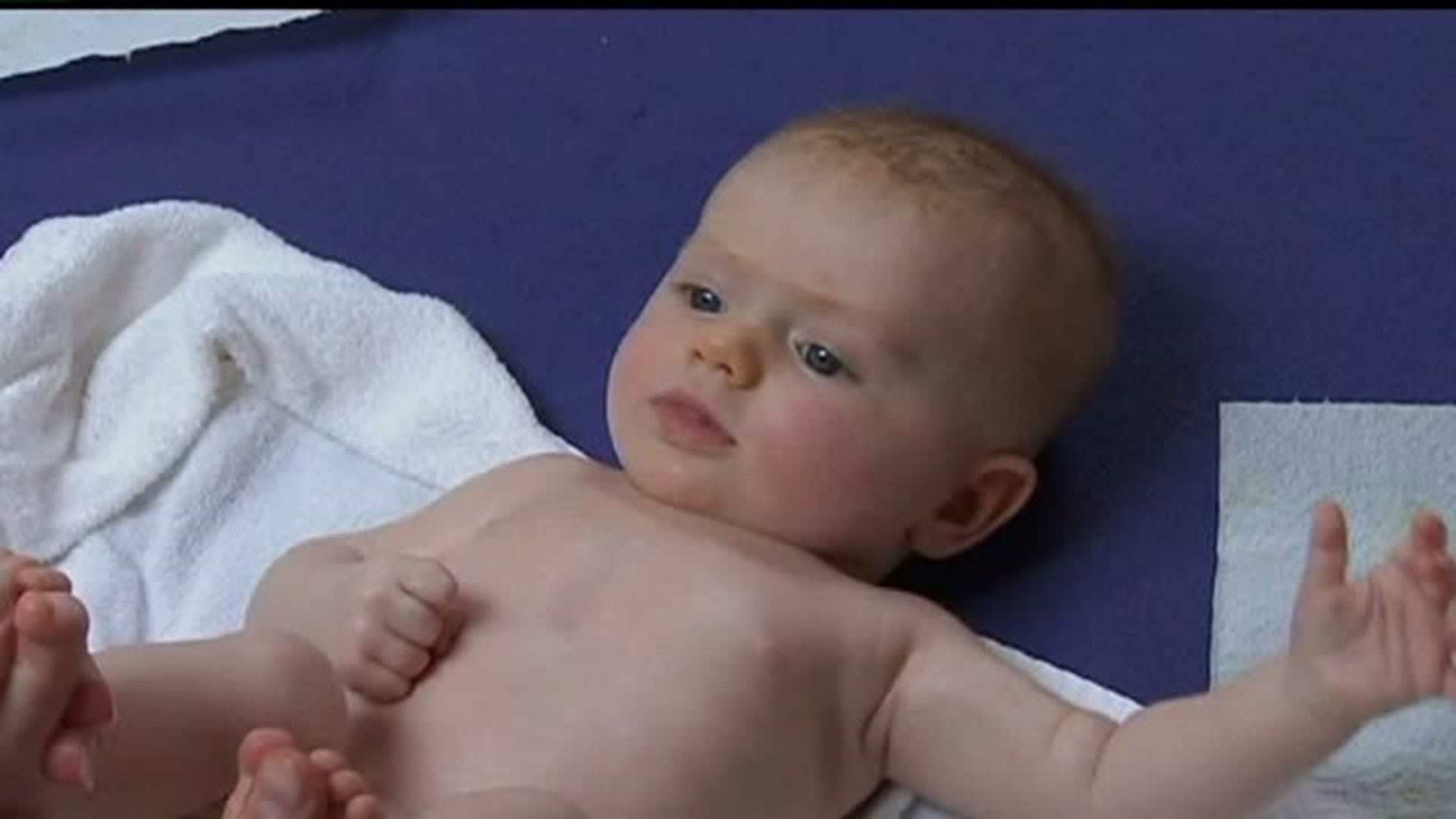 Diaper rash is a common problem for babies, but should not be much worry