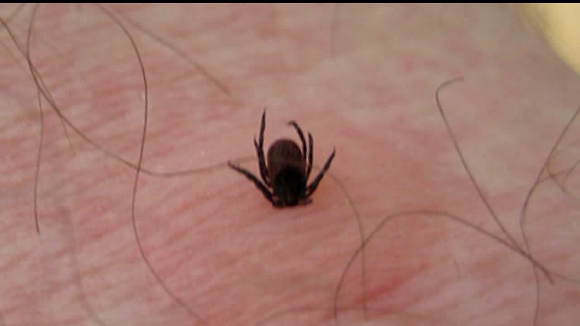 PA lyme disease cases high