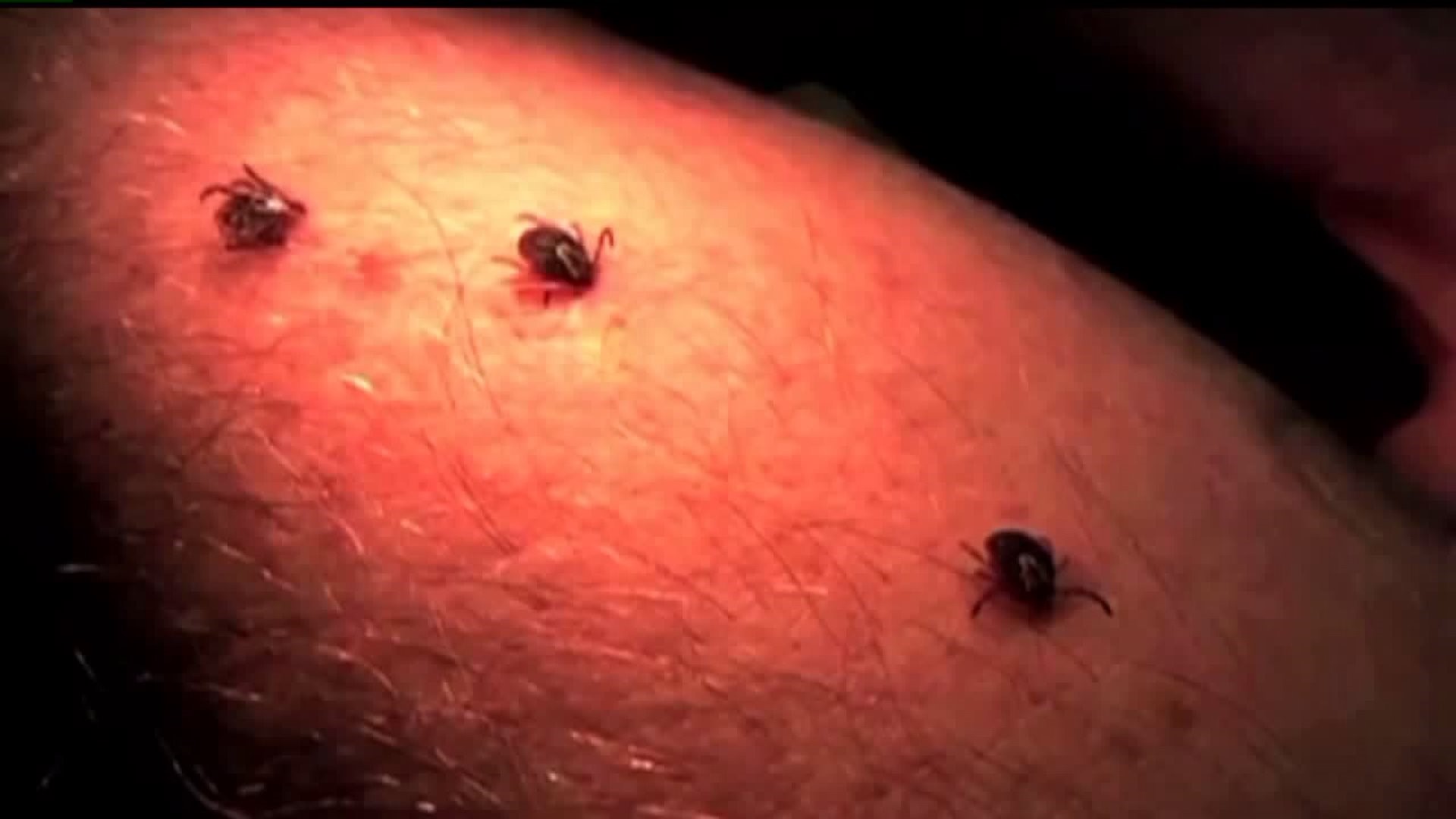 Health experts urge caution as PA enters "Lyme Season"