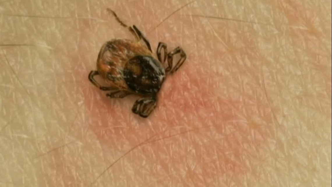 Experts urge tick season safety as Lyme Disease concerns grow - Vimarsana News