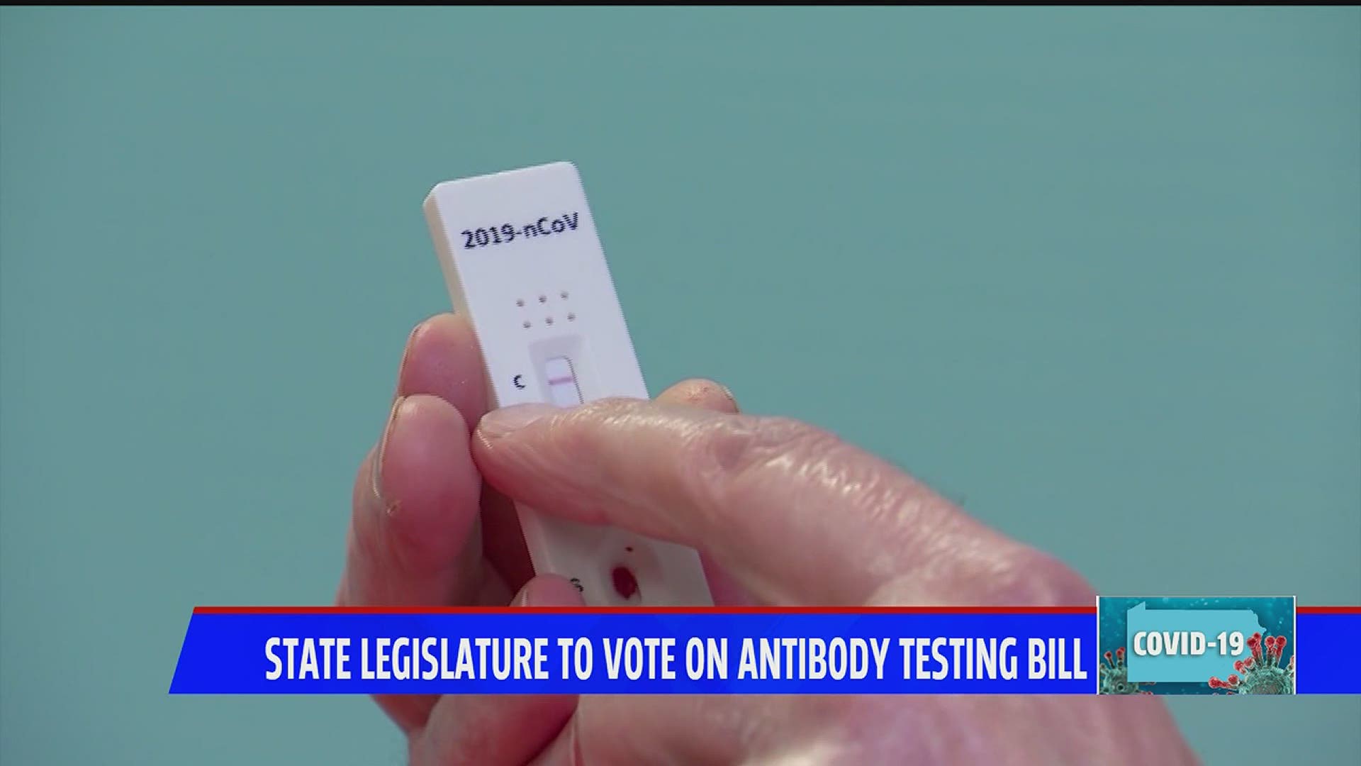 State Legislature to vote on antibody testing bill