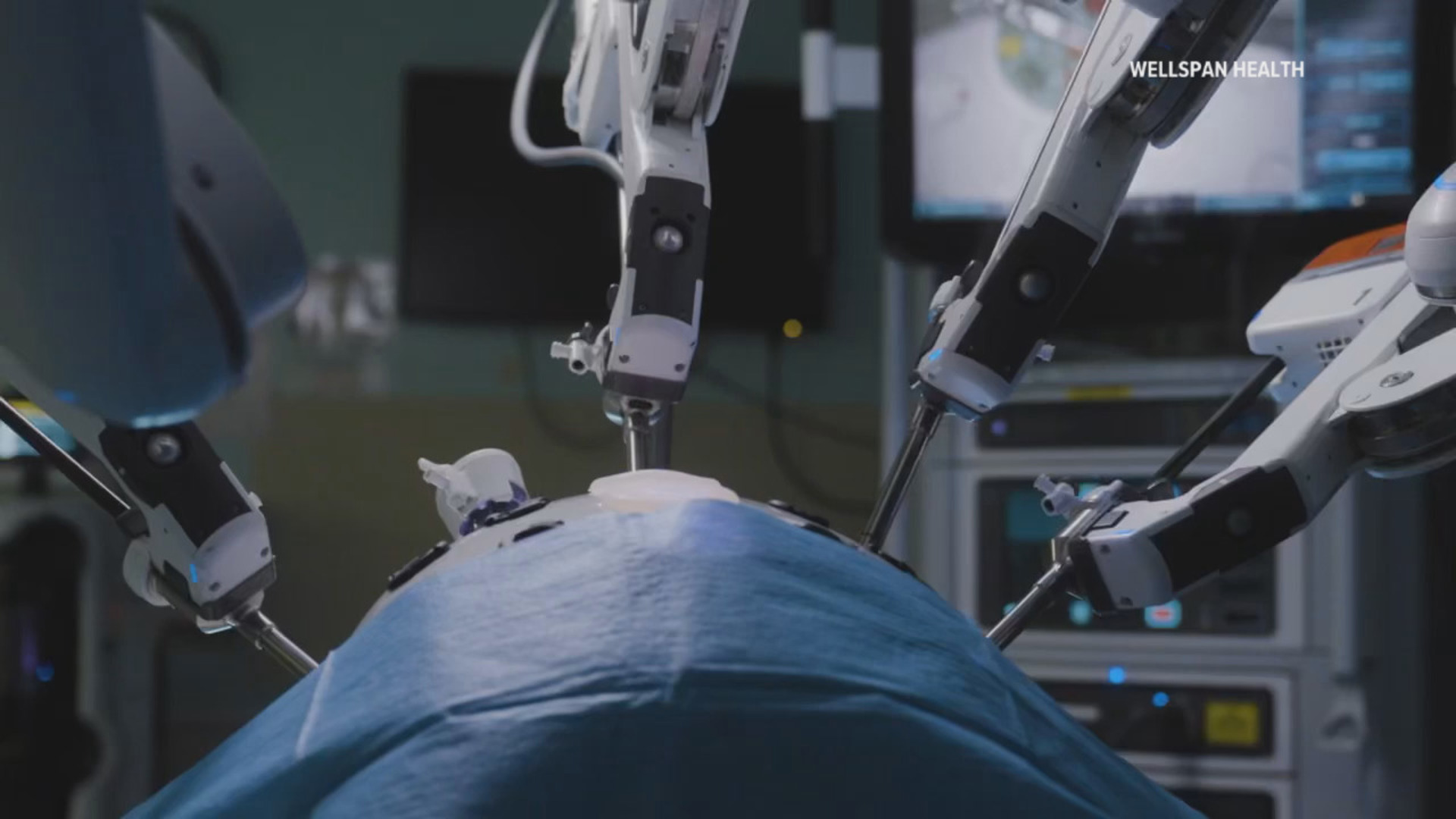 Lung cancer continues to be the number one cancer killer in the U.S., but new advancements in robotic technology are helping patients live longer and recover faster.