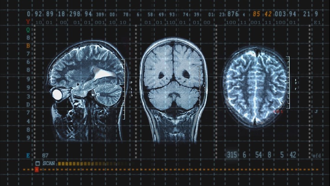 These high school sports have the highest concussion rates | fox43.com