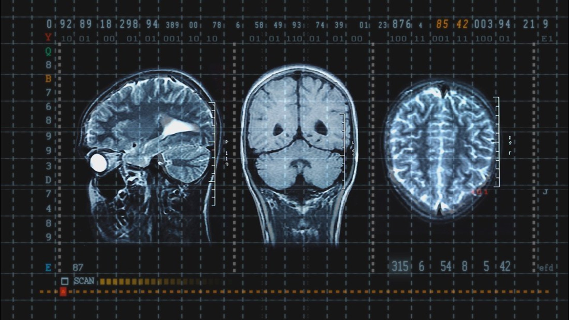 A new study identified biological changes in the saliva of pediatric concussion patients that can help predict who will need more treatment and time to recover.