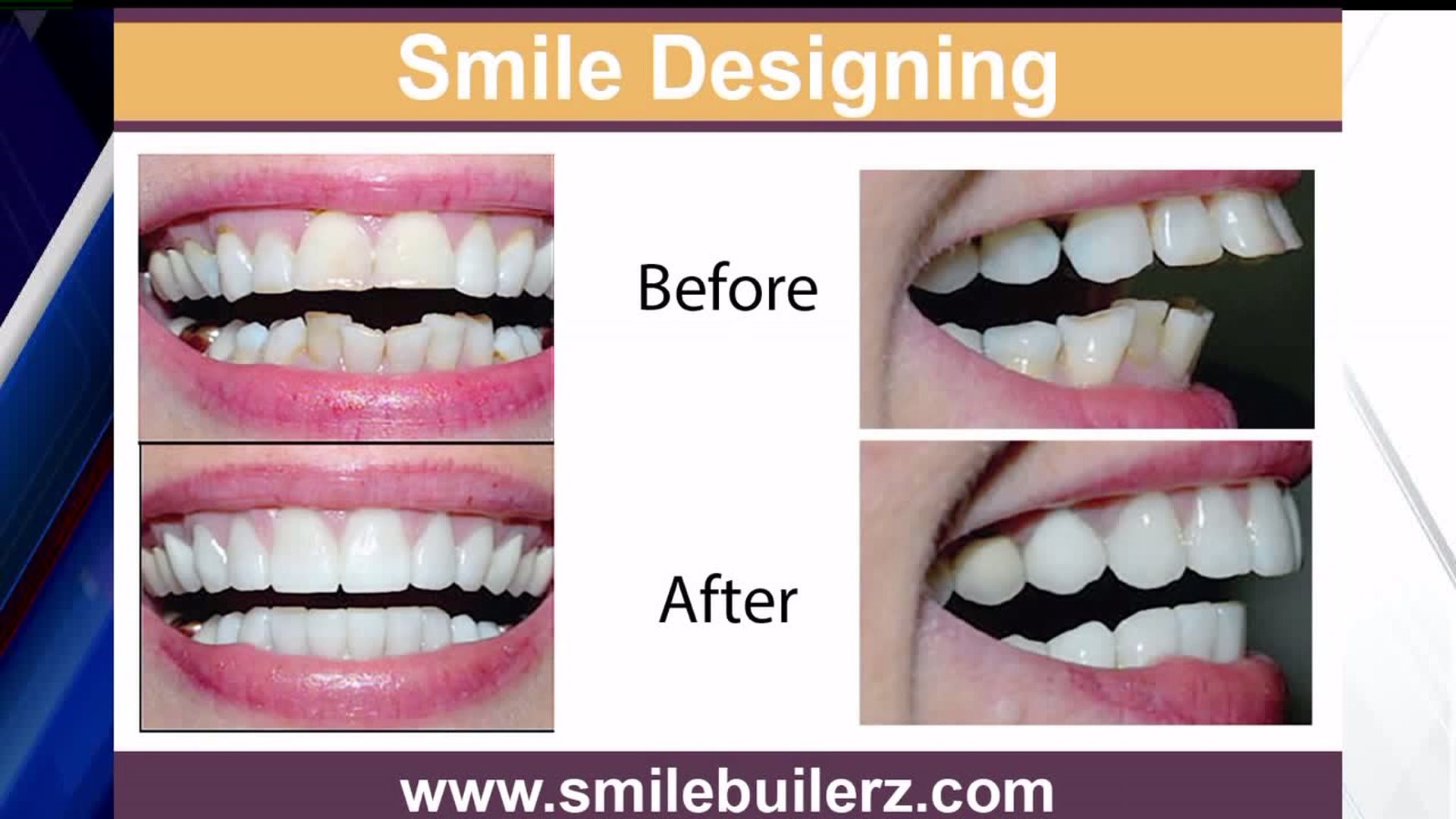 Cosmetic dentistry can keep your smile looking bright