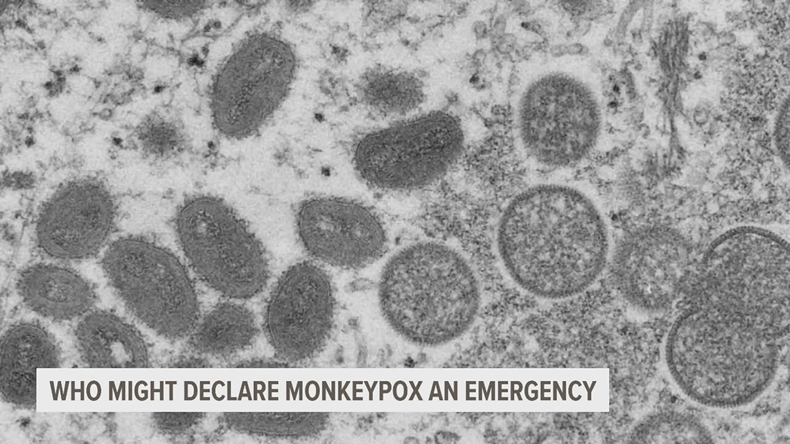 Local experts weigh in on the potential danger of Monkey Pox