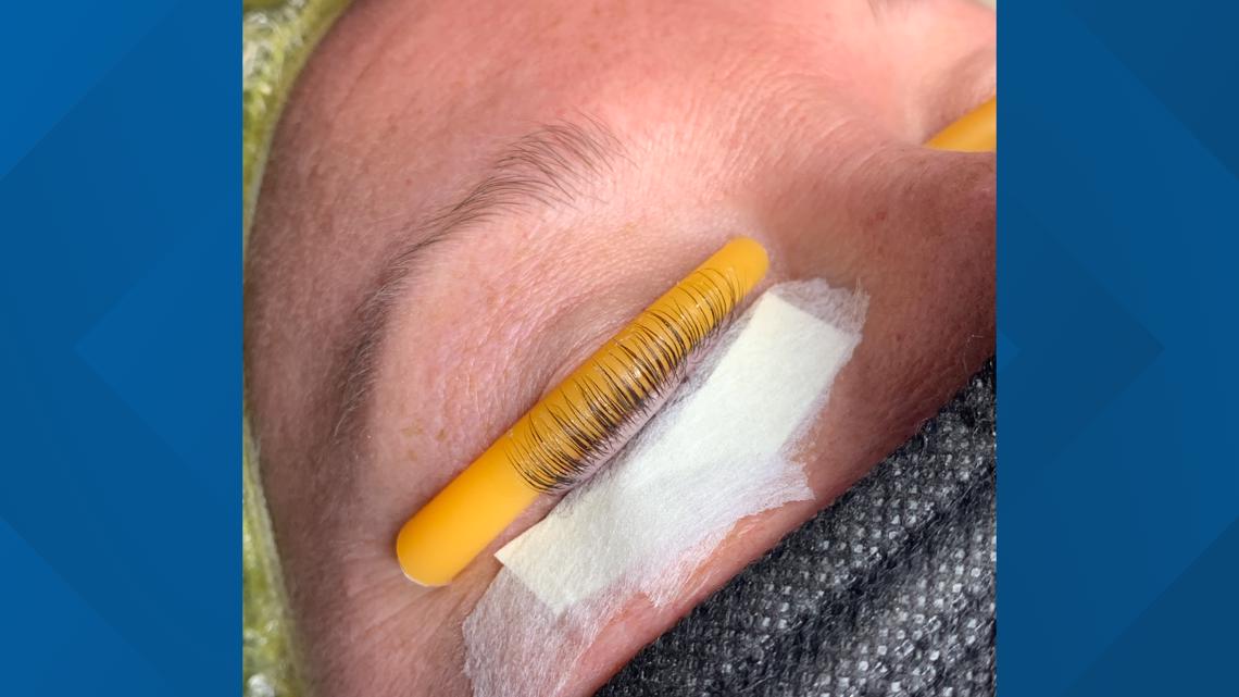 The dangers of eyelash procedures | Health Smart - Vimarsana News
