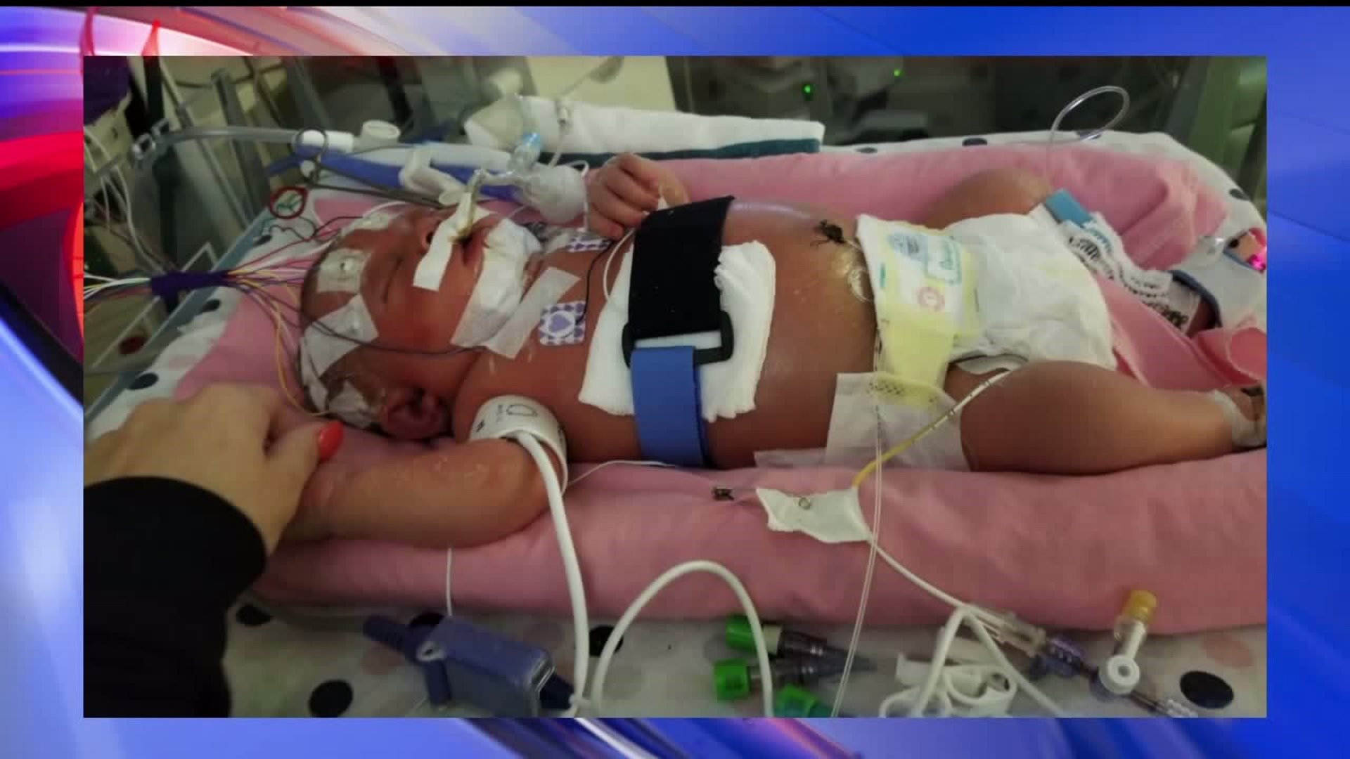 Baby girl dies from meningitis