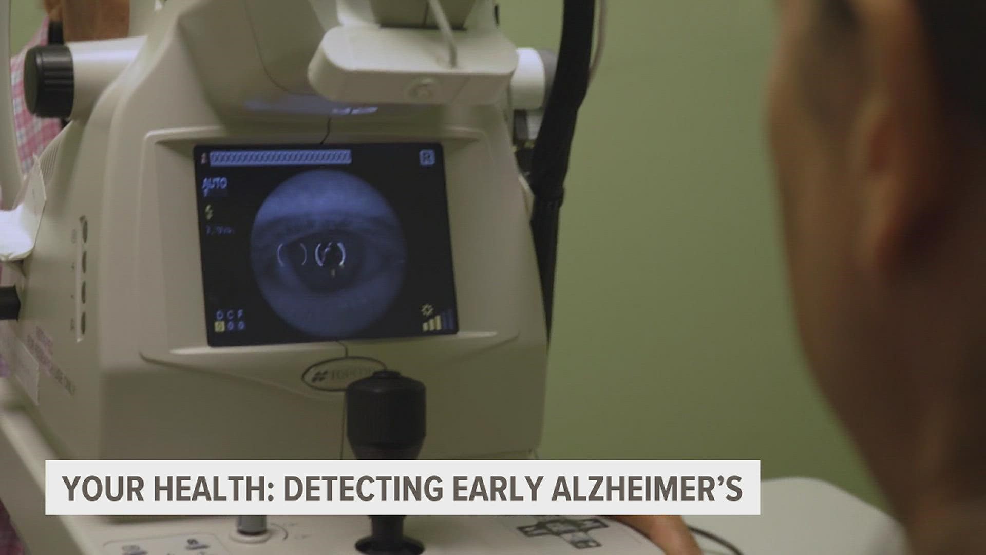Researchers are testing a new device that may make it easier to detect and diagnose Alzheimer's disease early.