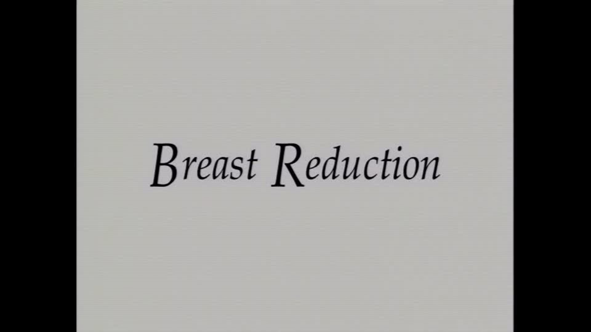 Dr. Eckhardt Breast Reduction