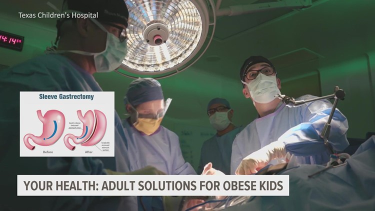 When doctors recommend weight loss surgery for children