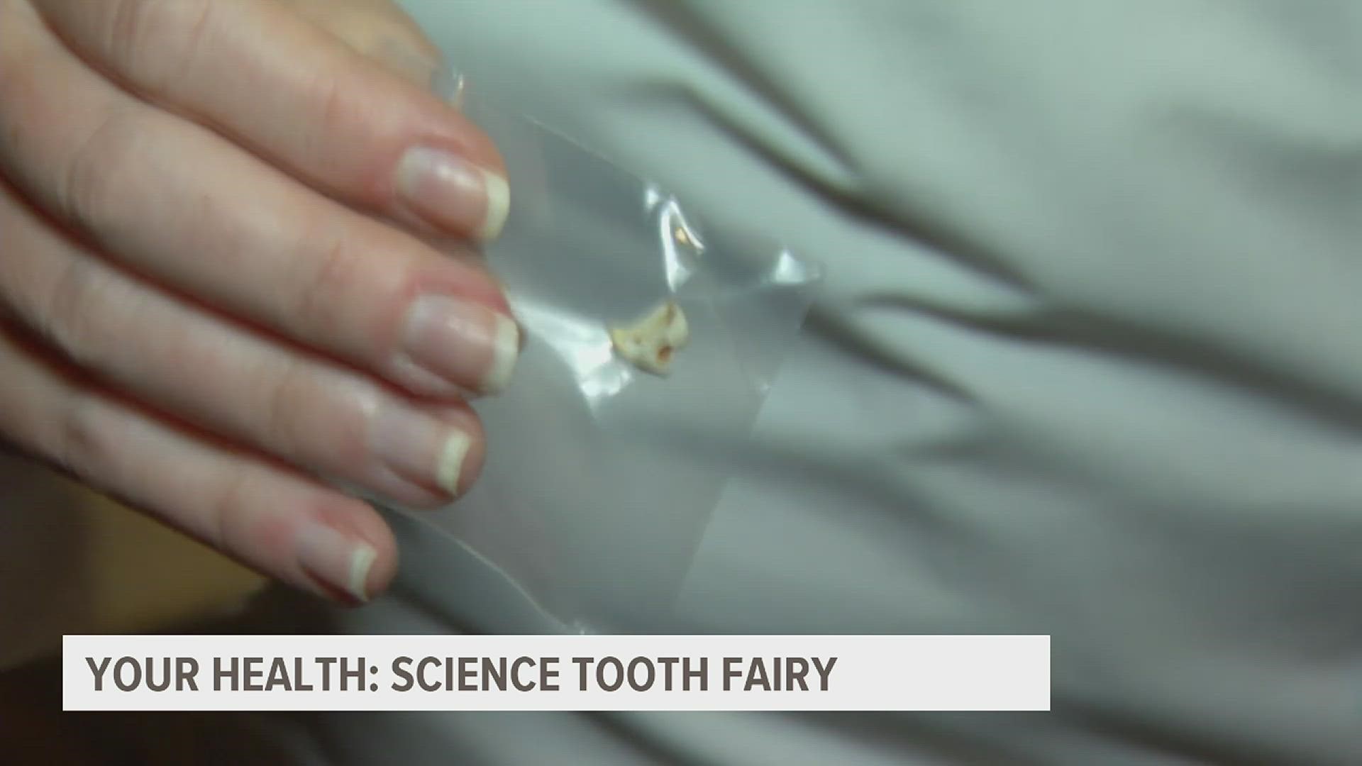 A Massachusetts scientist and her team want to know if children’s teeth can leave clues of early life stress.