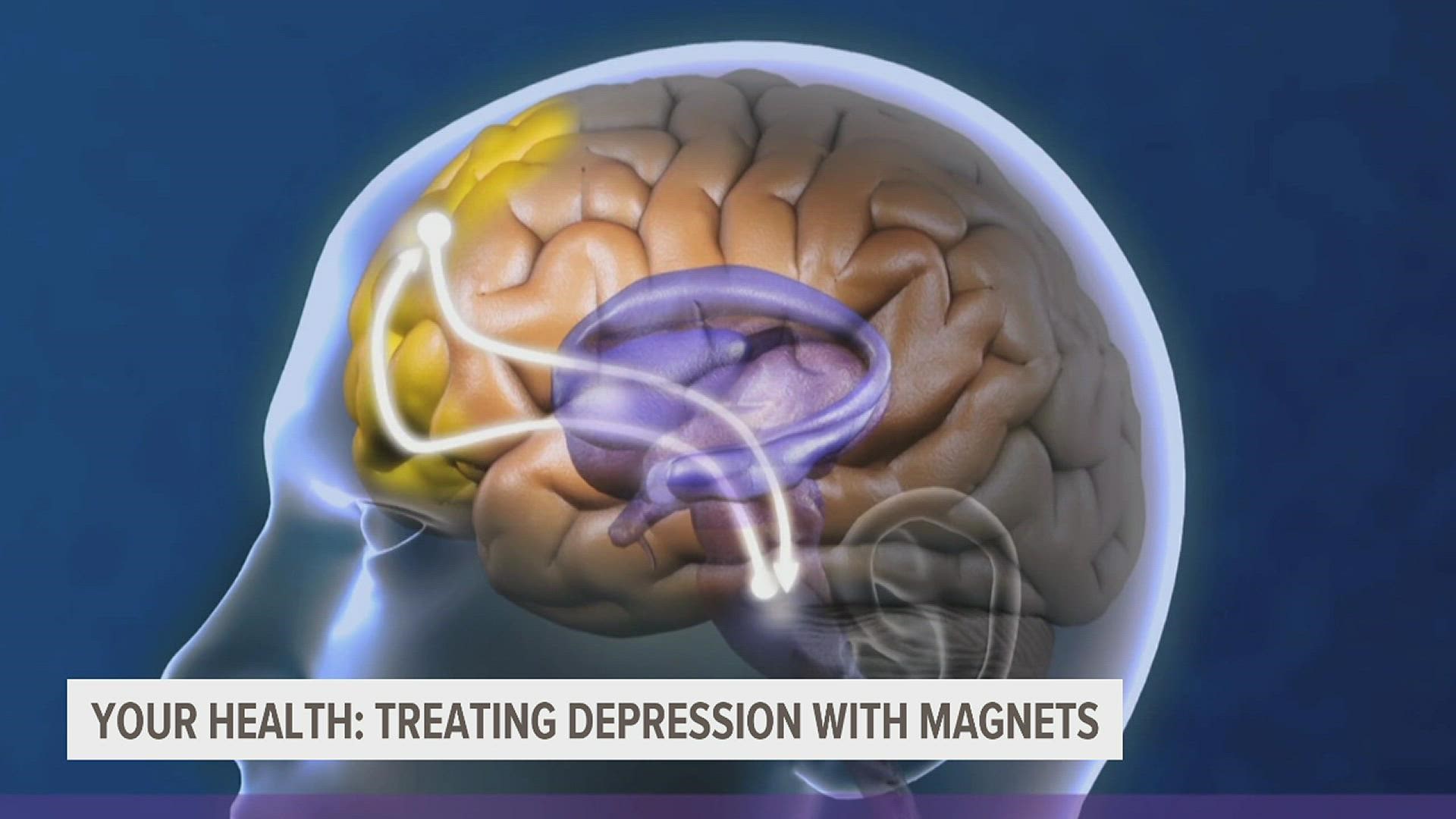 For some patients, supervised, short pulses of magnetic energy are helping unlock a world beyond major depressive disorder.