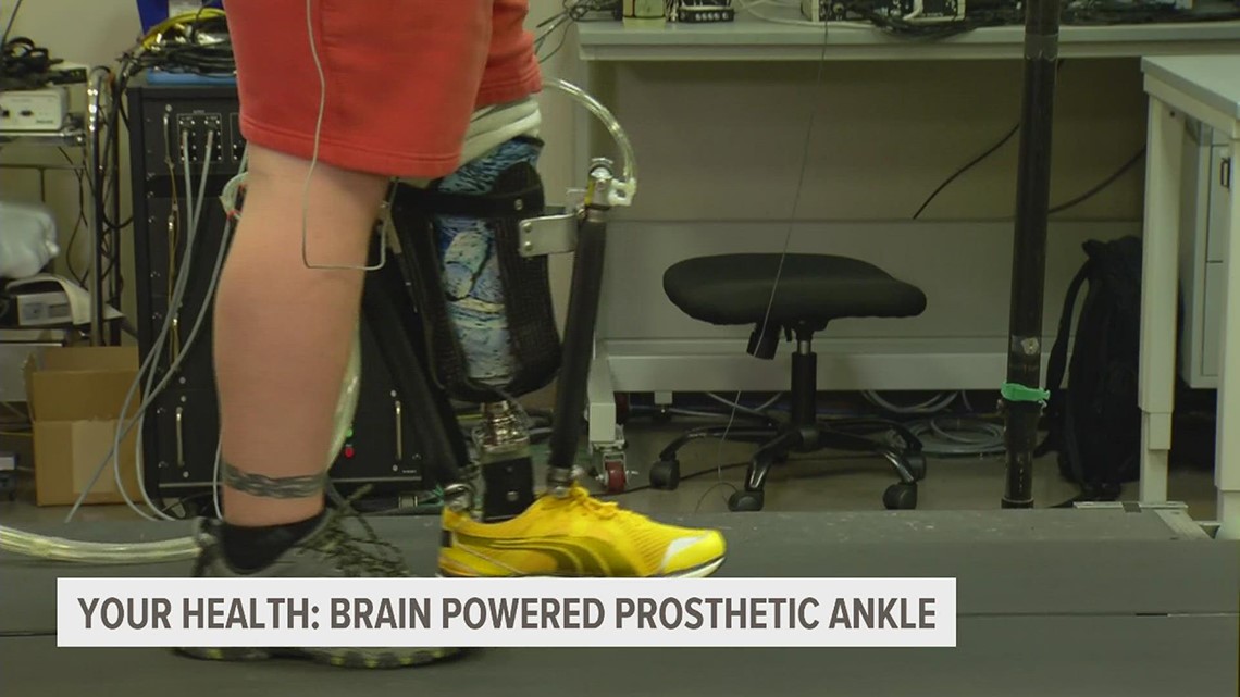 Your Health: Moving better with brain-powered prosthetic ankles - Vimarsana News