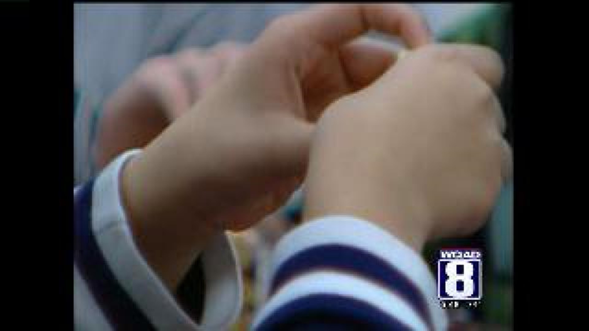 Food and skin allergies becoming more common in children