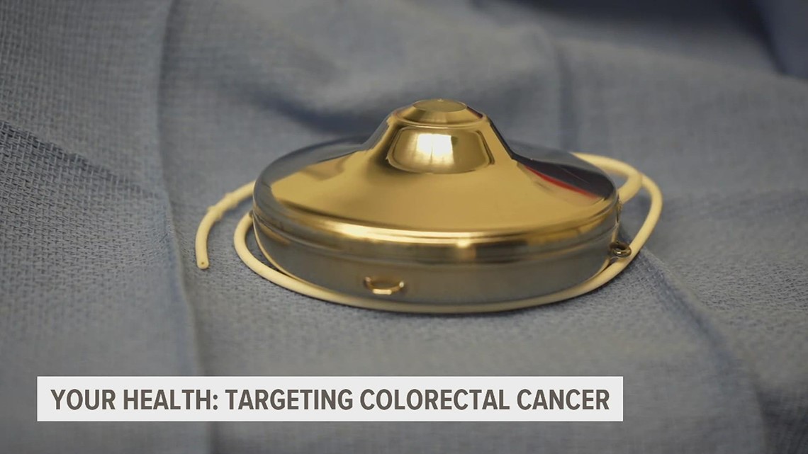 How a targeted chemo treatment from the 90s is killing today's colorectal cancer