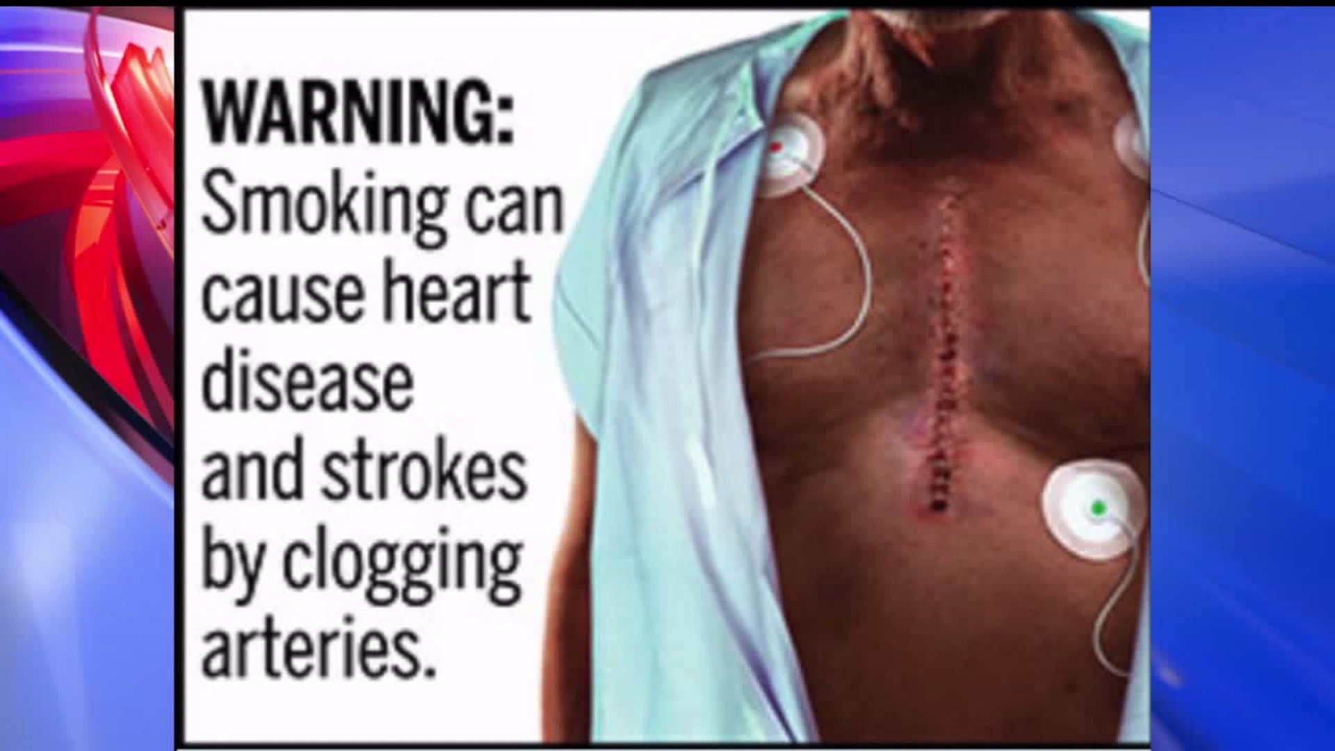 FDA proposes graphic cigarette label warnings
