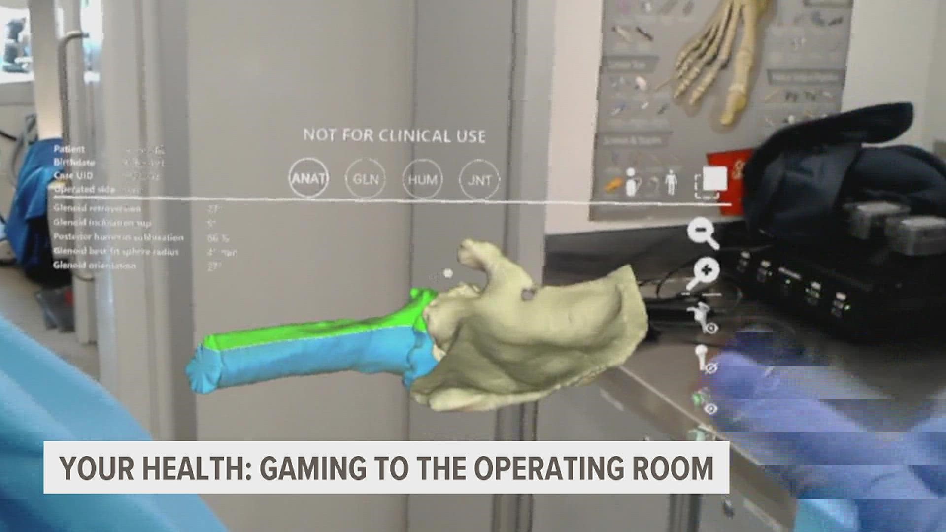 How doctors are using video game tech in the operating room | wqad.com