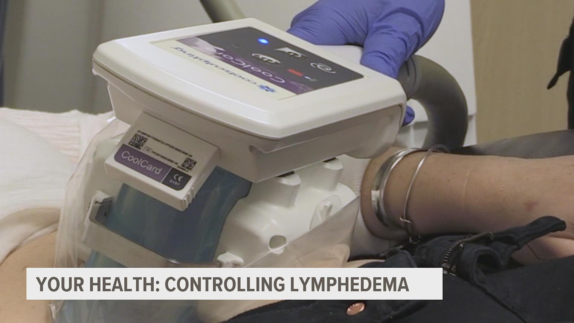 Lymphedema is a condition where fluid gets trapped in an arm or leg and causes swelling. Now, surgeons have better options for some patients.