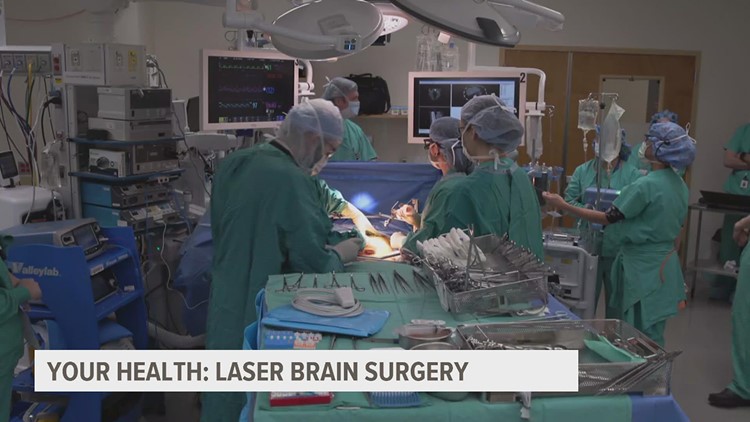 YOUR HEALTH: Laser surgery to stop seizures