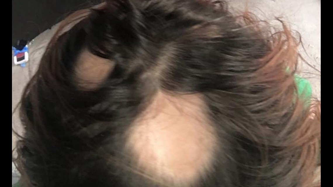 Hundreds of women join class action lawsuit claiming WEN hair care