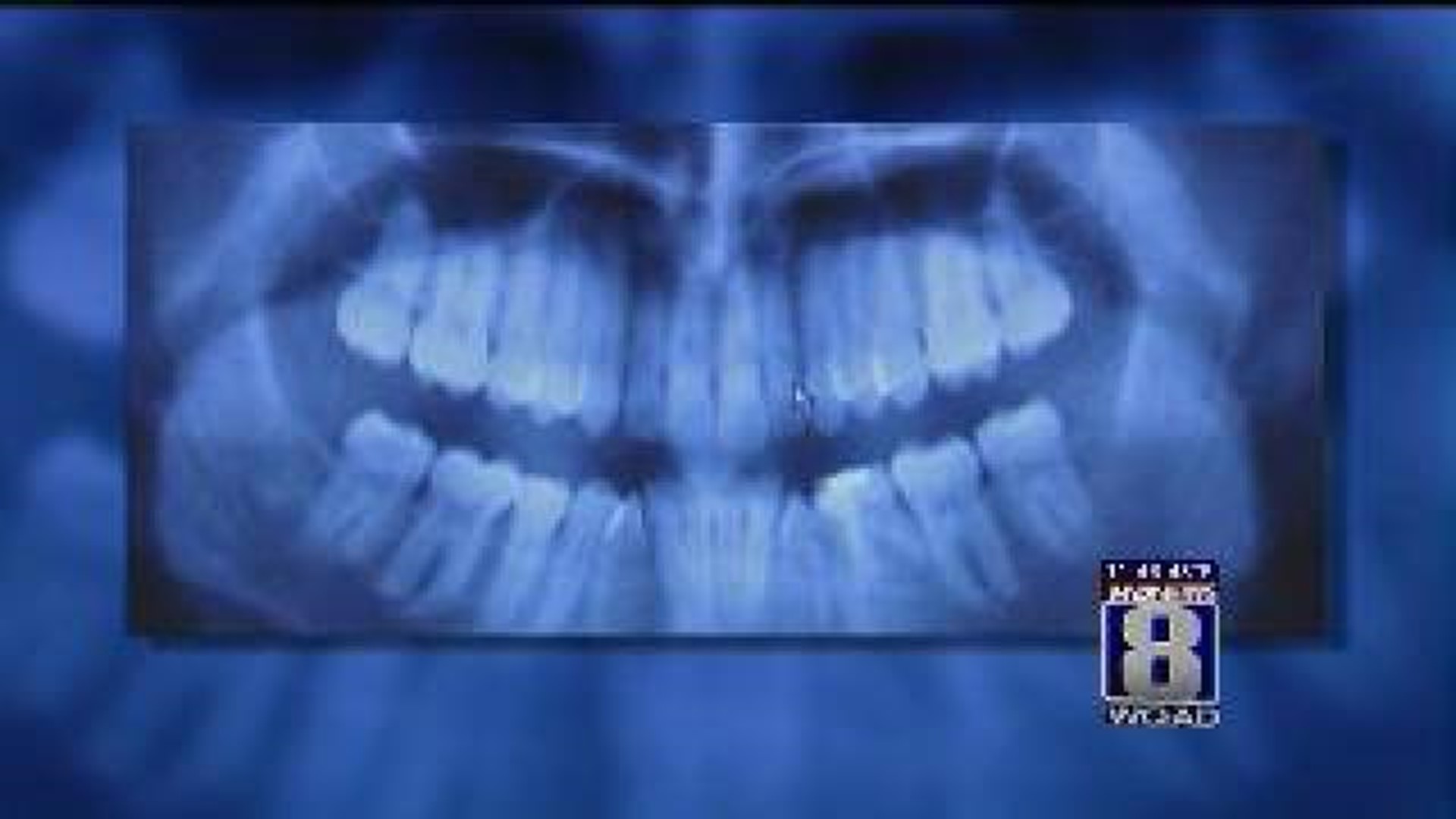 Study links dental x-rays to brain tumors