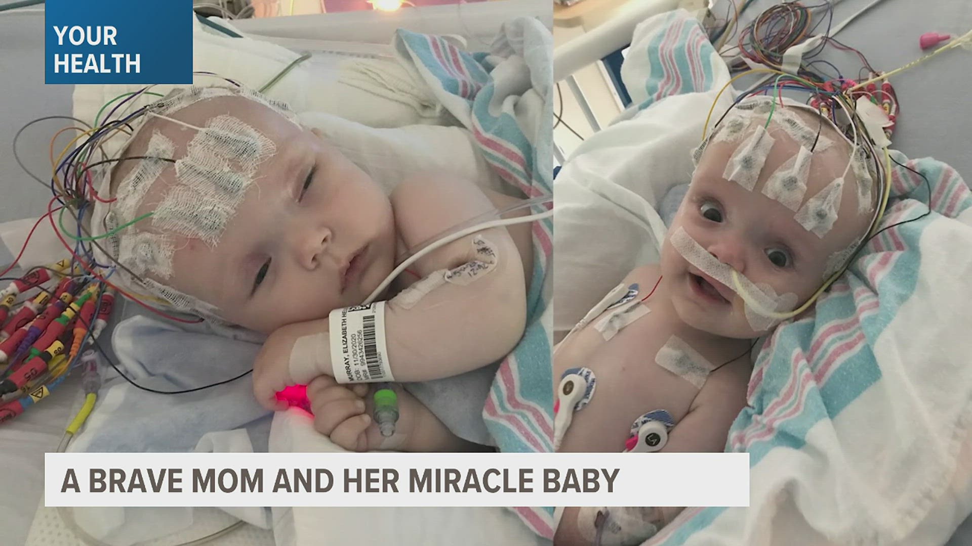 Children with brain tumors face an uphill battle for survival, but hear from one mom how her baby girl is thriving after she was diagnosed with a tumor before birth.